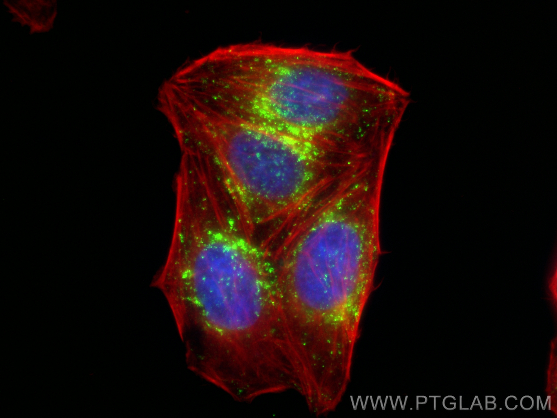 Immunofluorescence (IF) / fluorescent staining of HepG2 cells using Anti-Human CD107a / LAMP1 Rabbit Recombinant Antib (98266-2-RR)