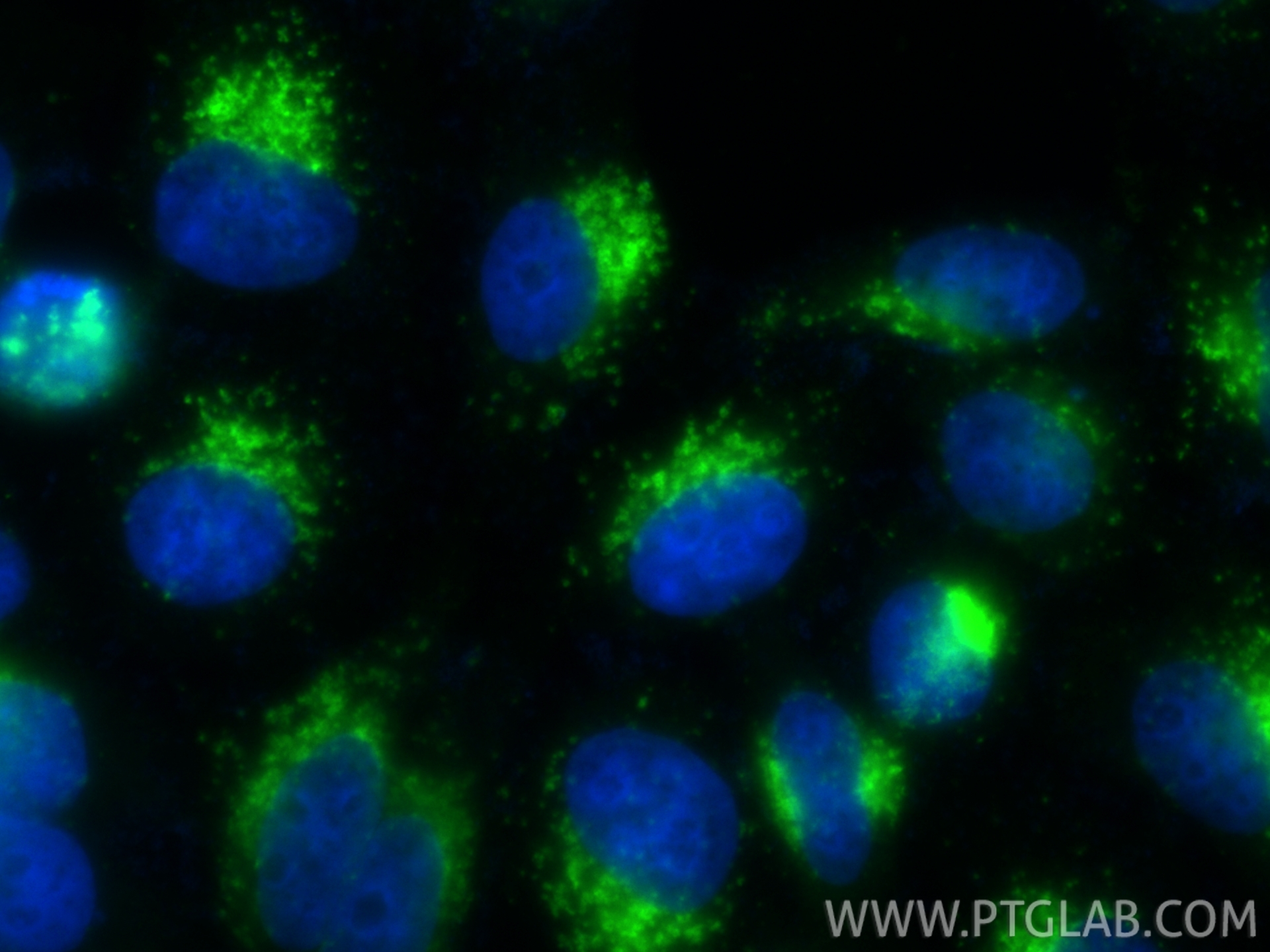Immunofluorescence (IF) / fluorescent staining of HepG2 cells using CoraLite® Plus 488 Anti-Human CD107a / LAMP1 Rabbi (CL488-98266-2)