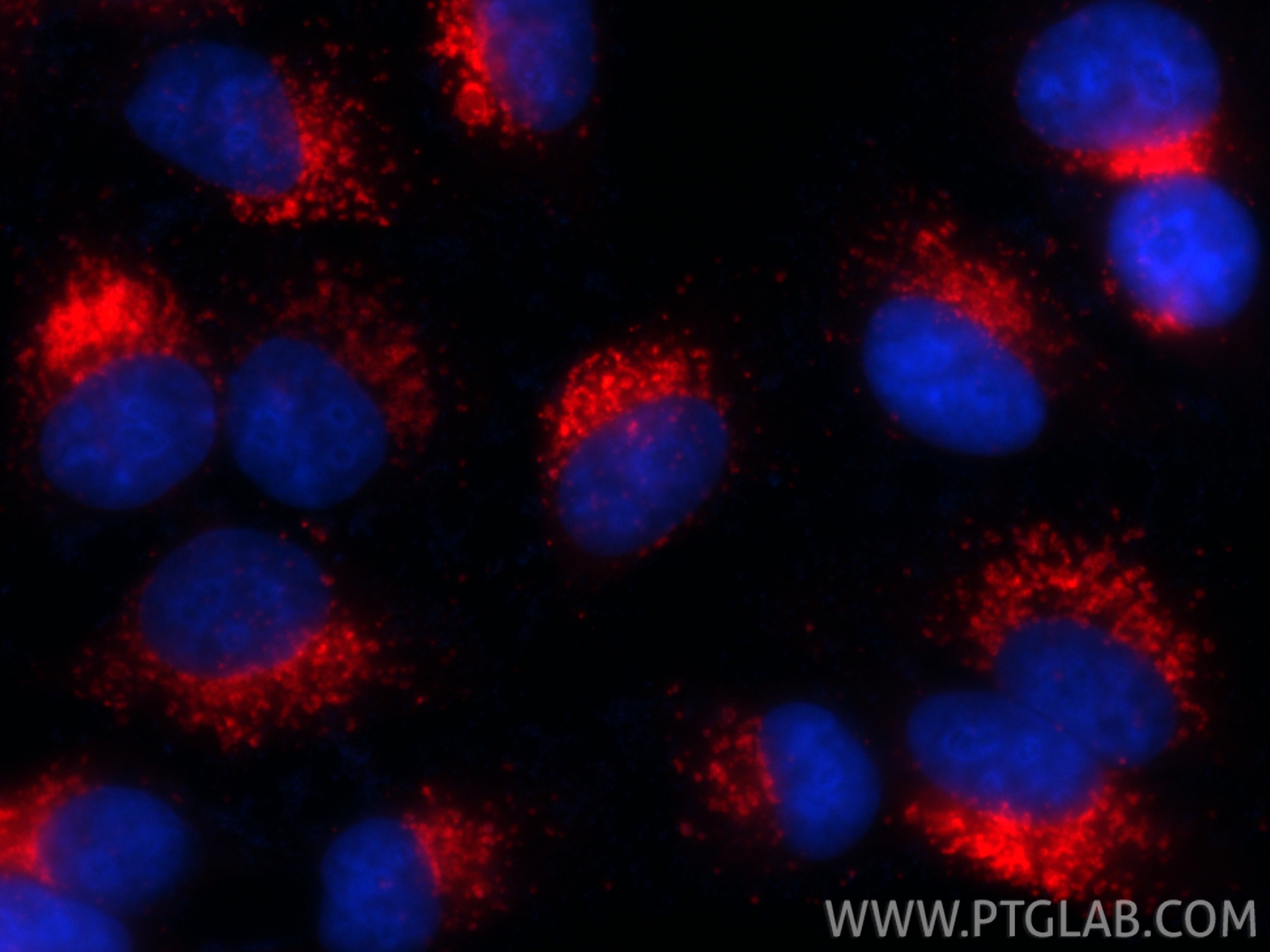 Immunofluorescence (IF) / fluorescent staining of HepG2 cells using CoraLite®594 Anti-Human CD107a / LAMP1 Rabbit Reco (CL594-98266-2)