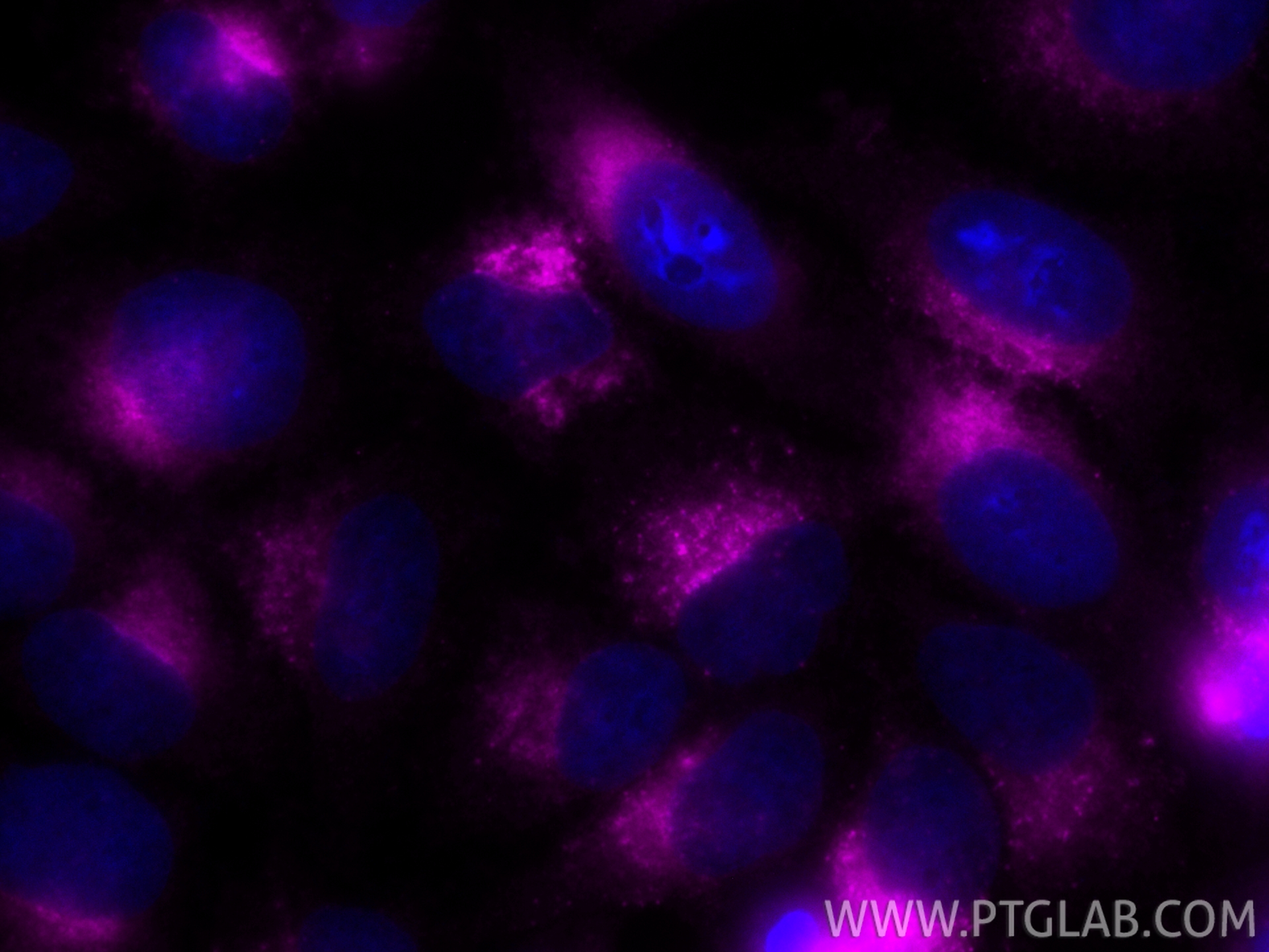 Immunofluorescence (IF) / fluorescent staining of HepG2 cells using CoraLite® Plus 647 Anti-Human CD107a / LAMP1 Rabbi (CL647-98266-2)