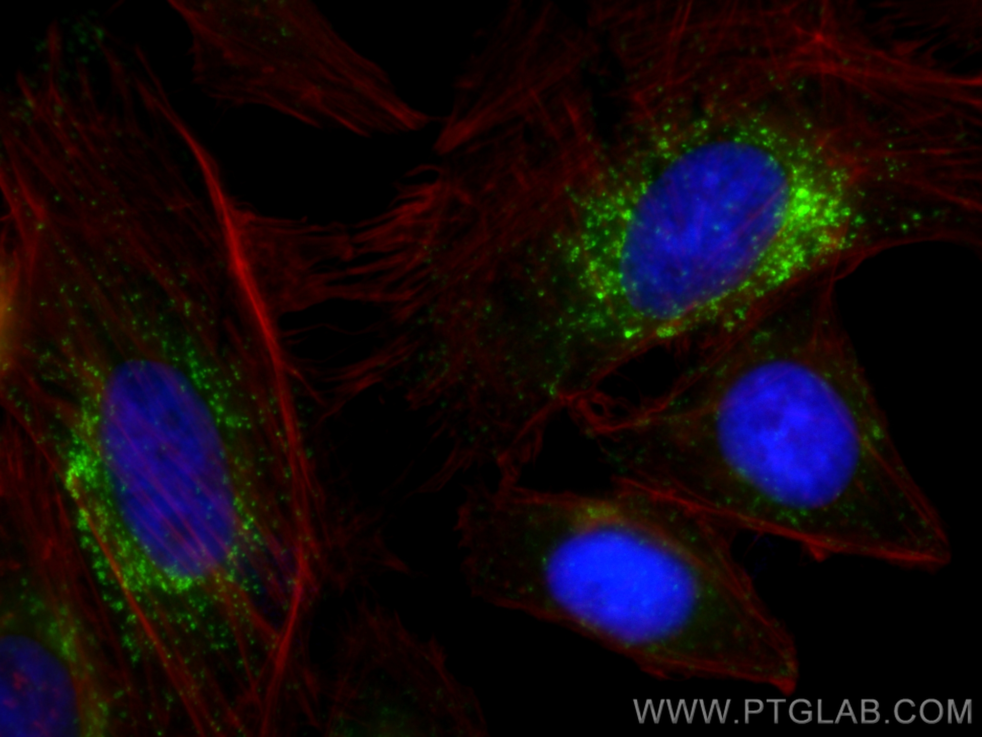Immunofluorescence (IF) / fluorescent staining of HepG2 cells using Multi-rAb™ CD107a / LAMP1 Multi-Recombinant antibo (RMX00025)