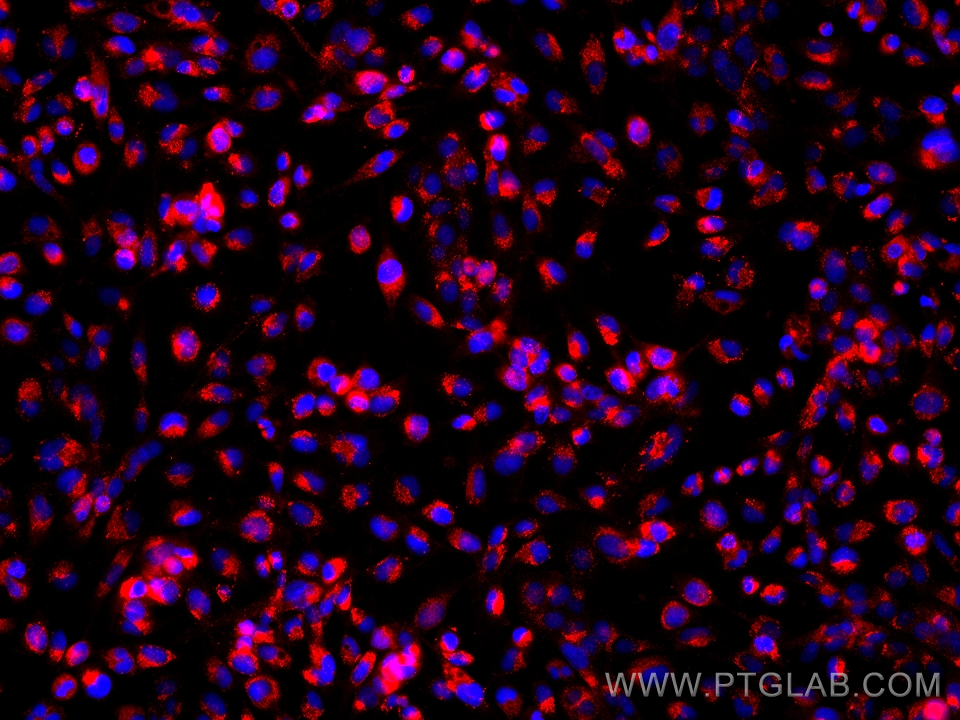 Immunofluorescence (IF) / fluorescent staining of U-251 cells using Anti-Human CD107b / LAMP2 (H4B4) (65053-1-Ig)