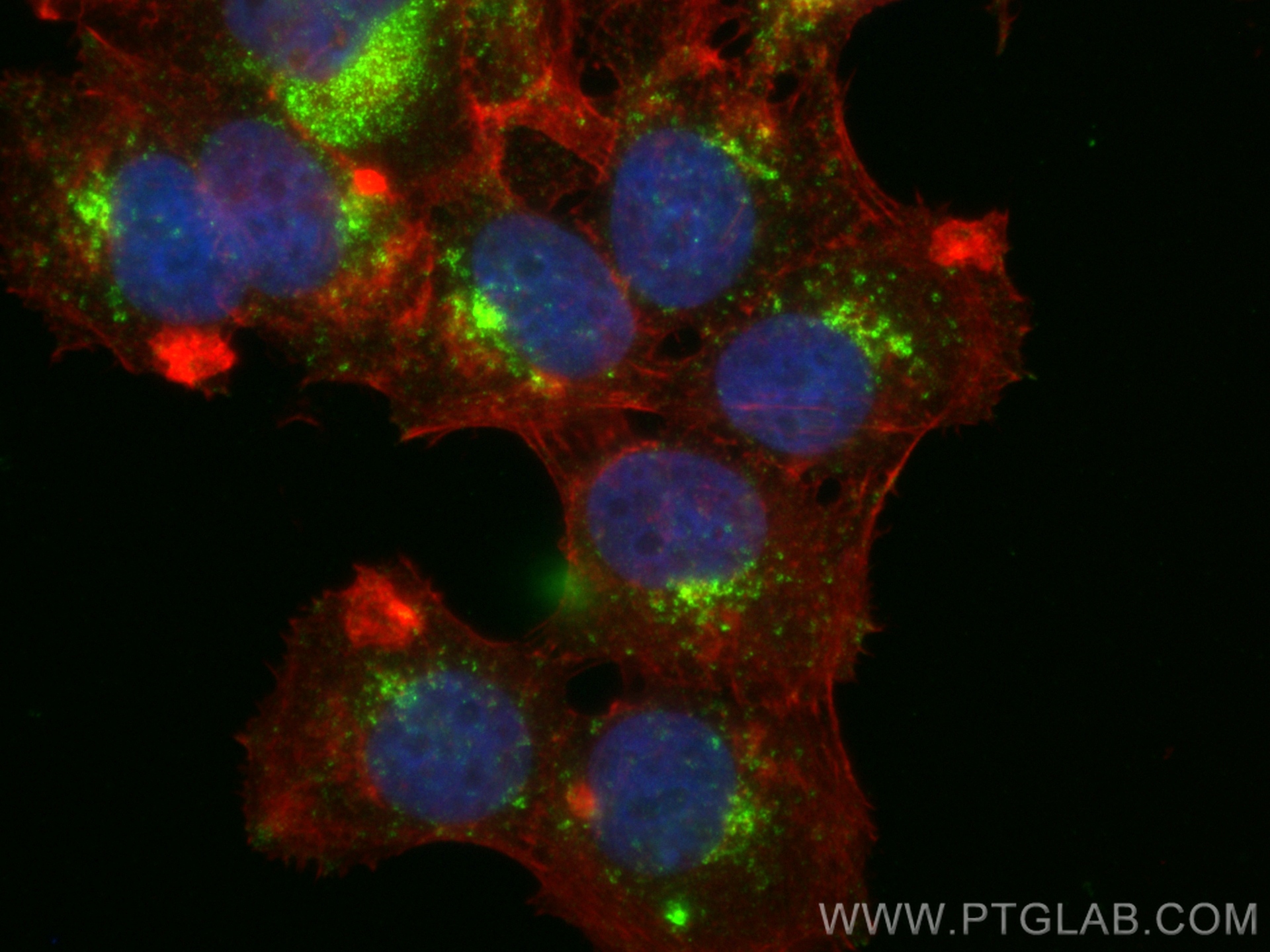 Immunofluorescence (IF) / fluorescent staining of MCF-7 cells using Anti-Human CD107b / LAMP2 (H4B4) (65053-1-Ig)