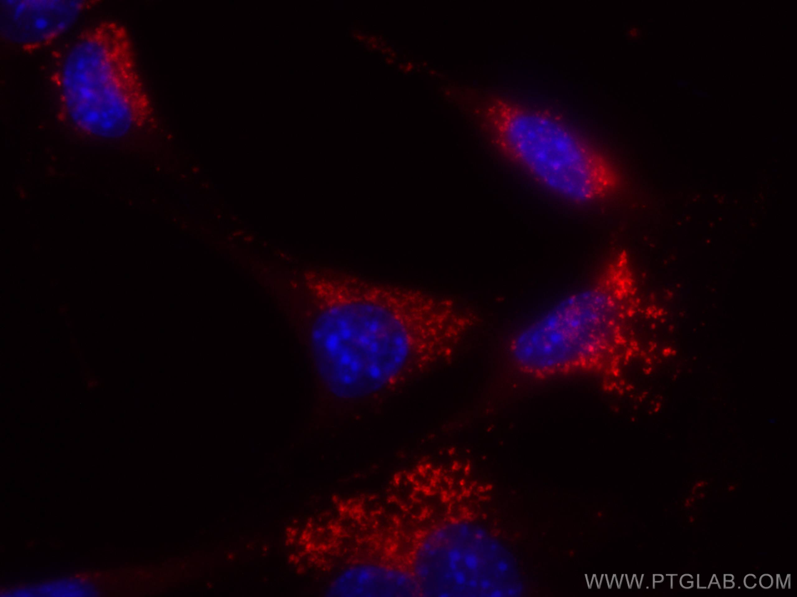 Immunofluorescence (IF) / fluorescent staining of NIH/3T3 cells using CoraLite® Plus 555 Anti-Mouse CD107b / LAMP2 (ABL- (CL555-65052)