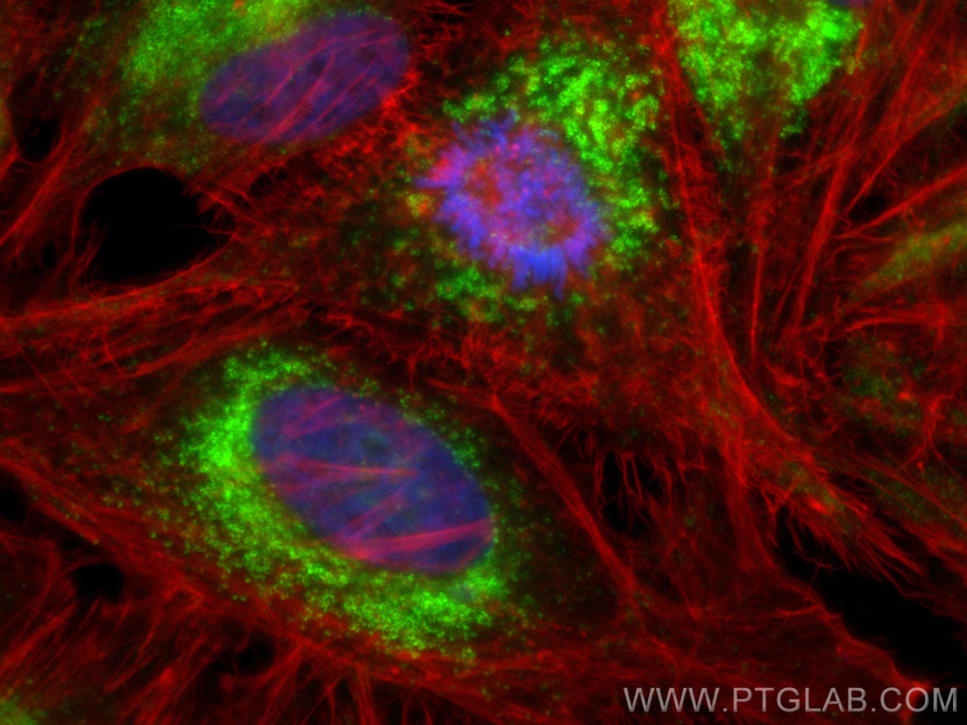 Immunofluorescence (IF) / fluorescent staining of HeLa cells using Anti-Human CD107b / LAMP2 (H4B4) Mouse IgG2a Recom (65566-1-MR)