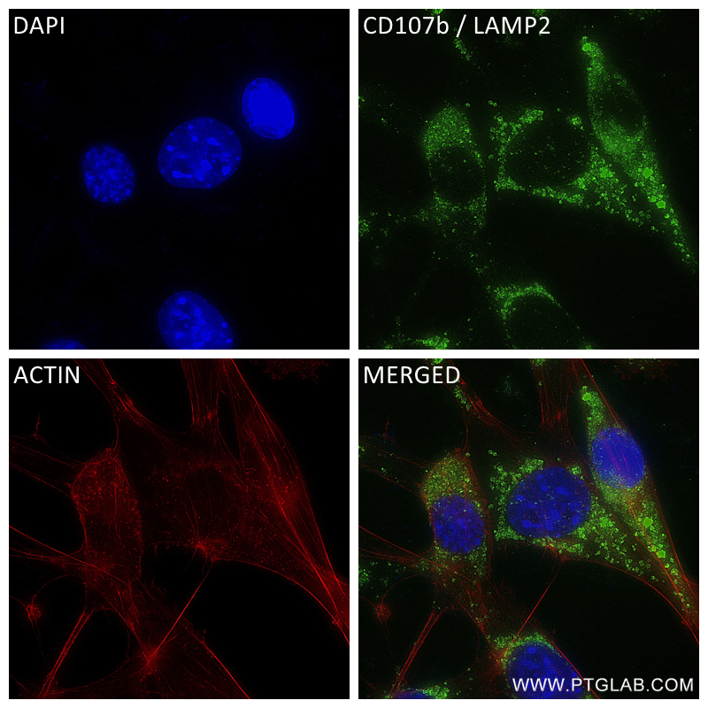 Immunofluorescence (IF) / fluorescent staining of NIH/3T3 cells using CD107b / LAMP2 Recombinant antibody (84474-3-RR)