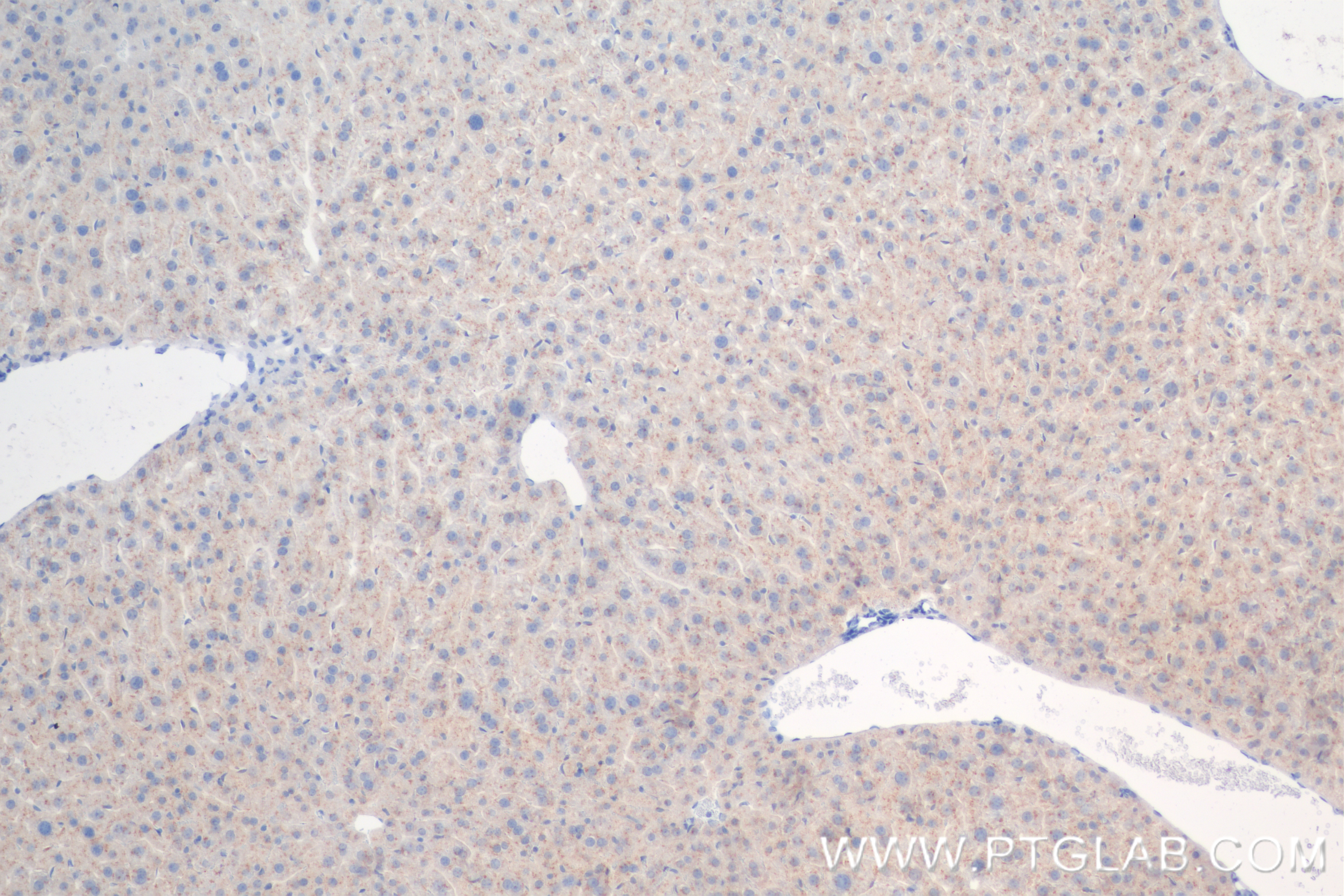 Immunohistochemistry (IHC) staining of mouse liver tissue using CD107b / LAMP2 Recombinant antibody (84474-3-RR)