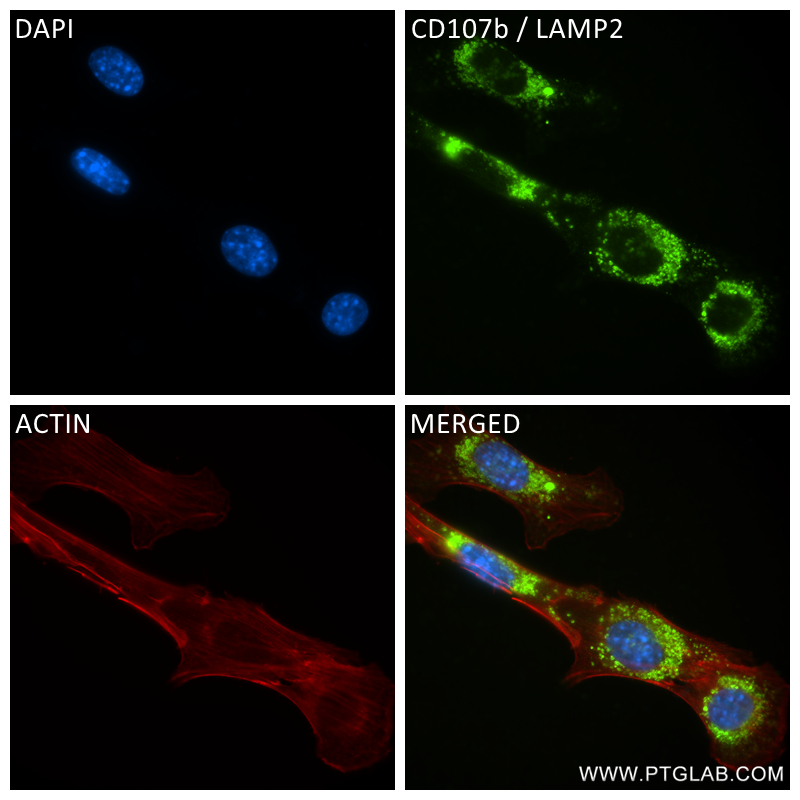 Immunofluorescence (IF) / fluorescent staining of NIH/3T3 cells using CD107b / LAMP2 Recombinant antibody (84474-5-RR)