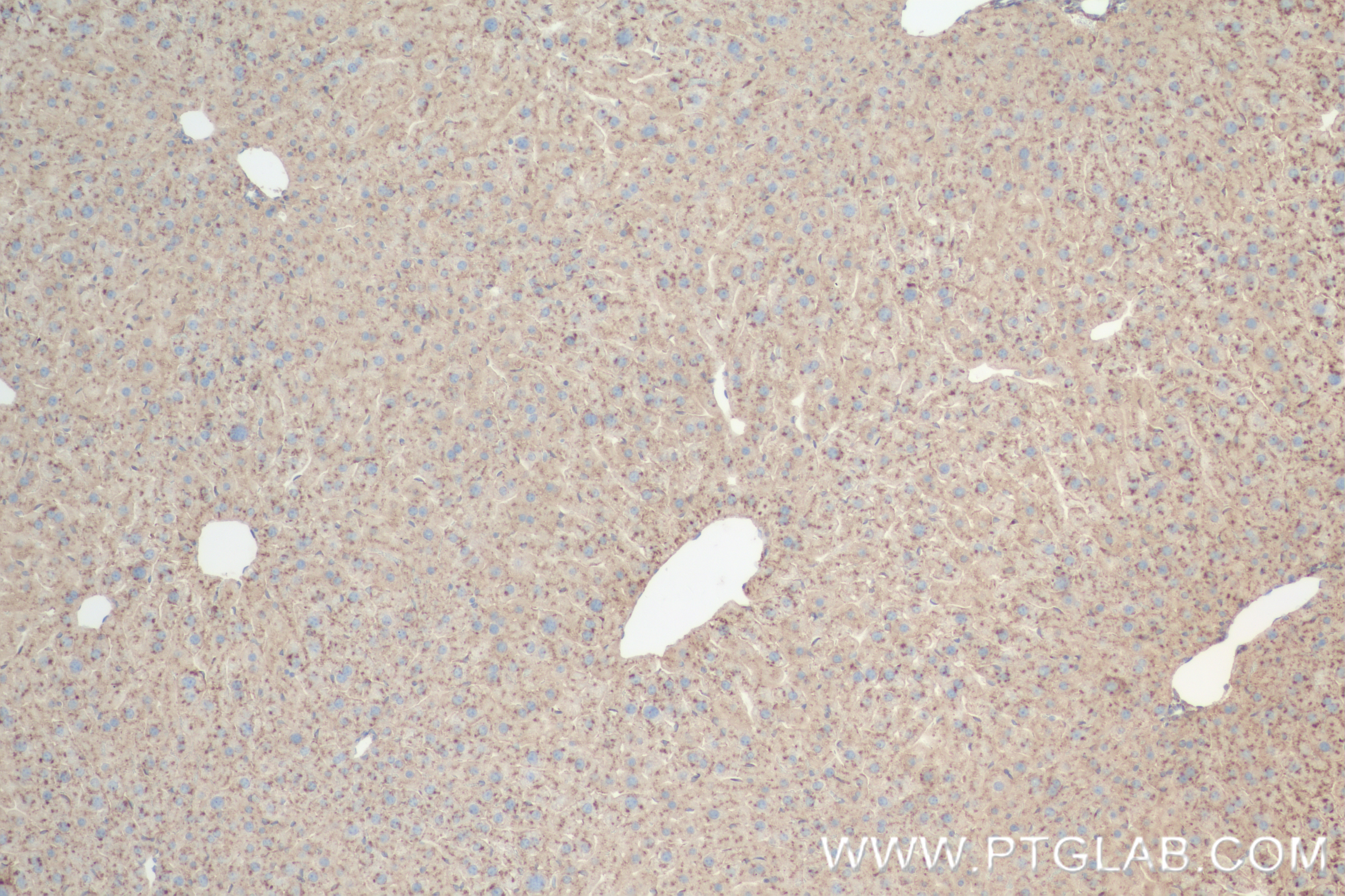 Immunohistochemistry (IHC) staining of mouse liver tissue using CD107b / LAMP2 Recombinant antibody (84474-5-RR)