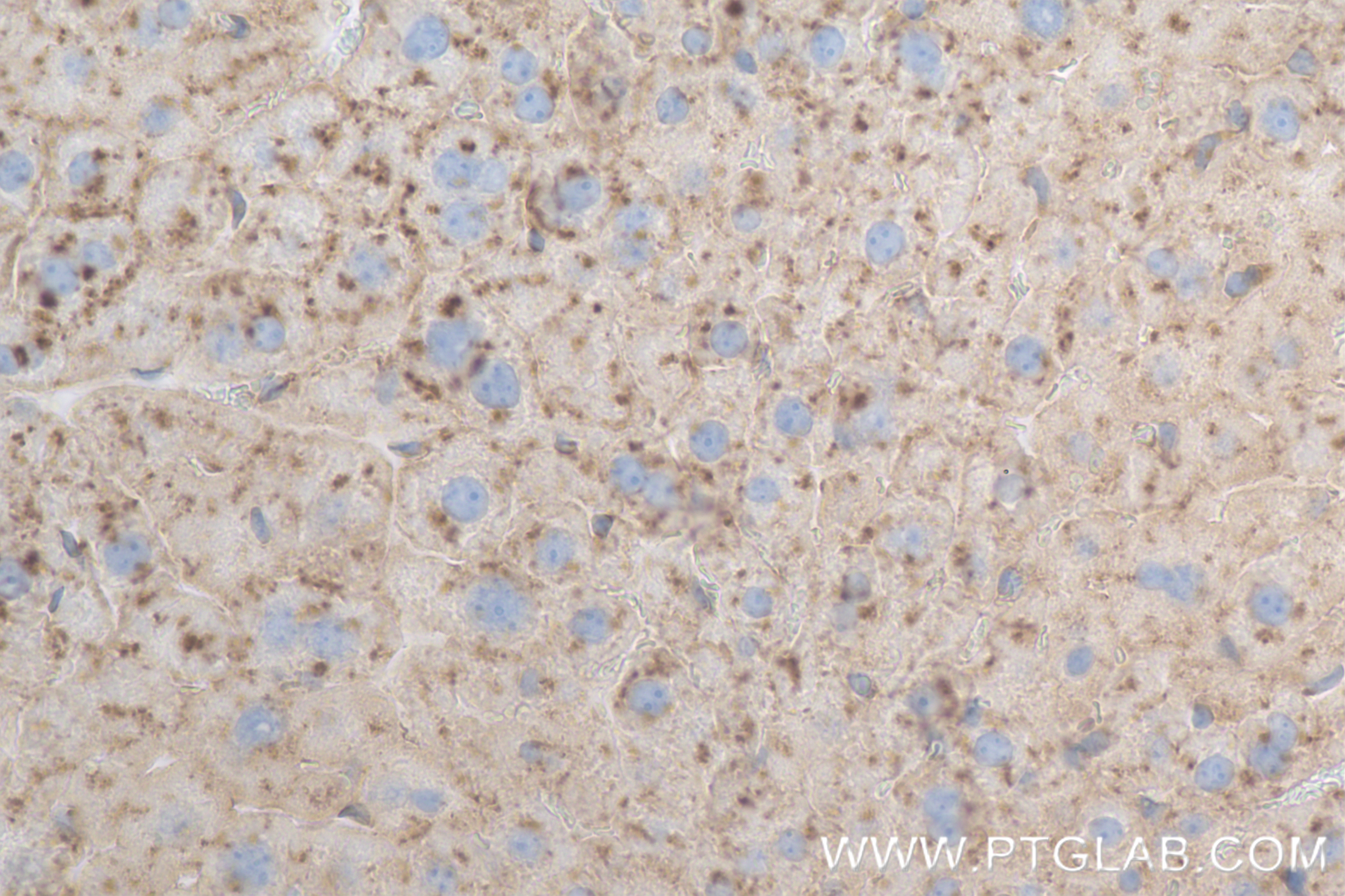 Immunohistochemistry (IHC) staining of mouse liver tissue using CD107b / LAMP2 Recombinant antibody (84474-5-RR)