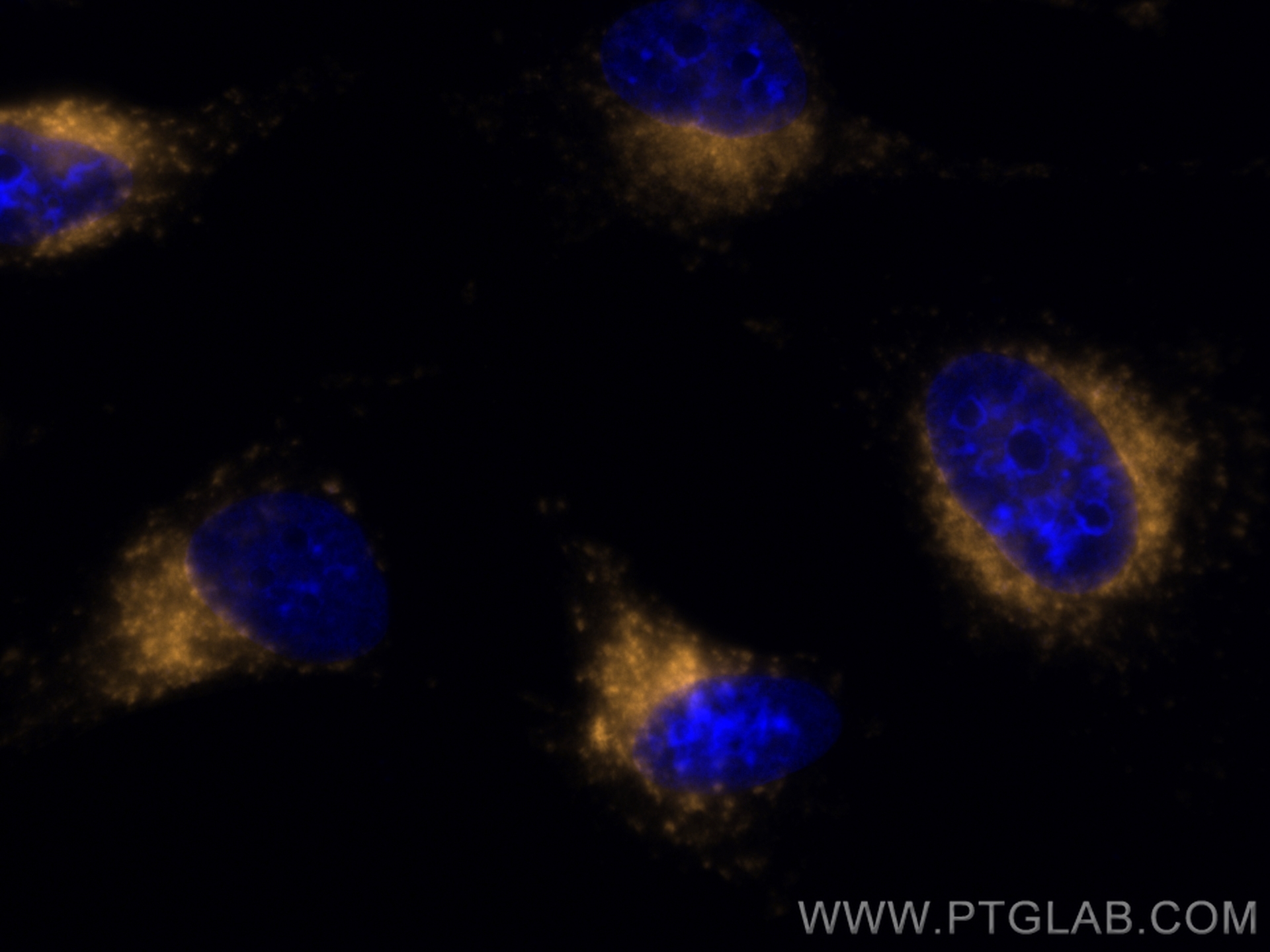 Immunofluorescence (IF) / fluorescent staining of HeLa cells using FcZero-rAb™ PE Anti-Human CD107b / LAMP2 (H4B4) Ra (PE-FcA65566)