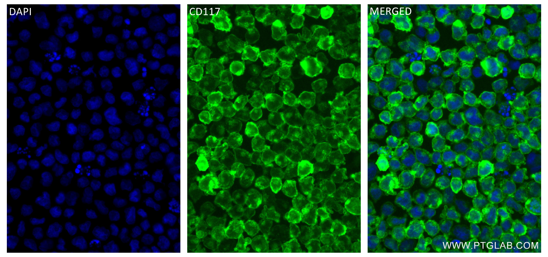 Immunofluorescence (IF) / fluorescent staining of Mo7e cells using CD117/c-Kit Recombinant antibody (84259-3-RR)