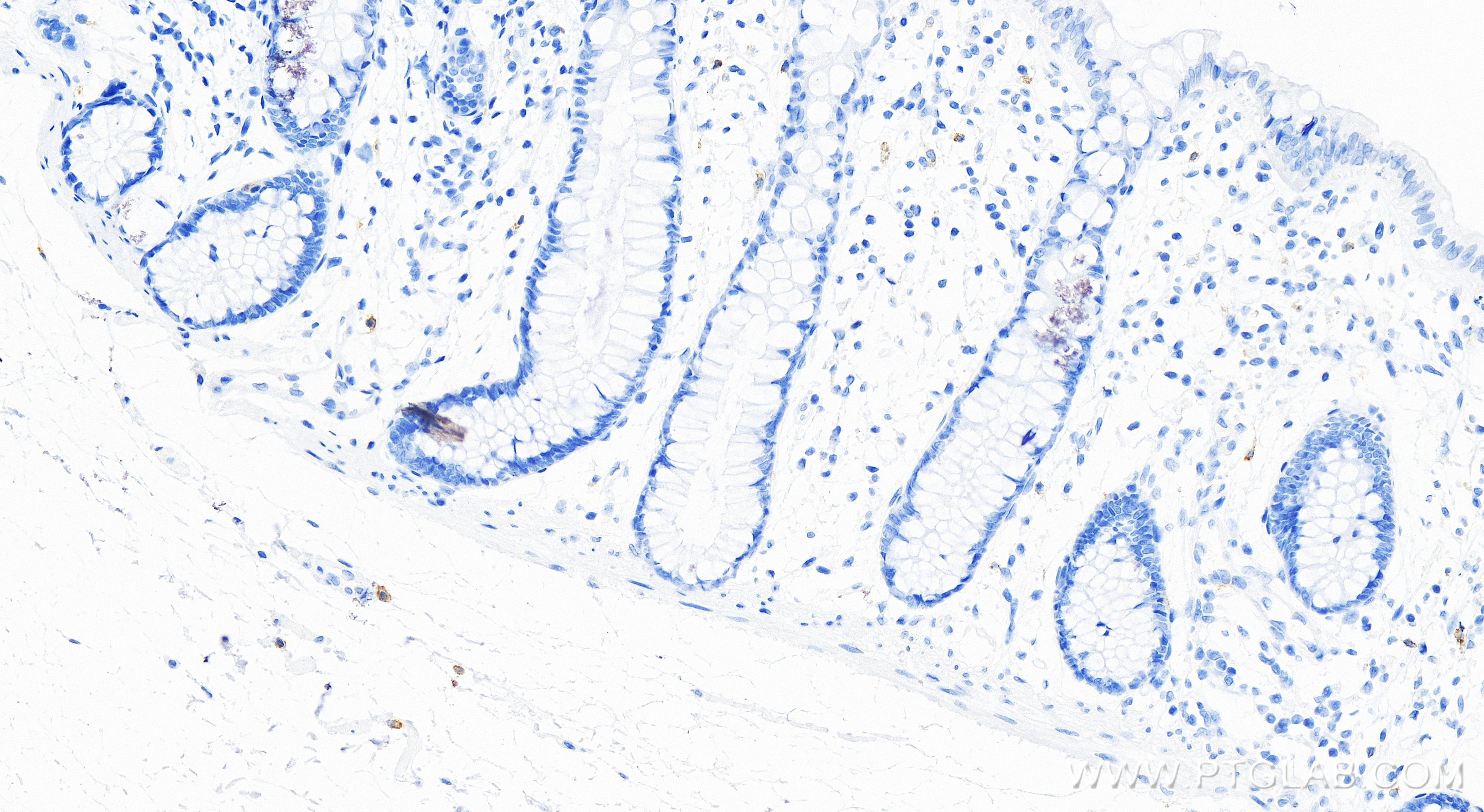 Immunohistochemistry (IHC) staining of human colon tissue using CD117/c-Kit Recombinant antibody (84259-3-RR)