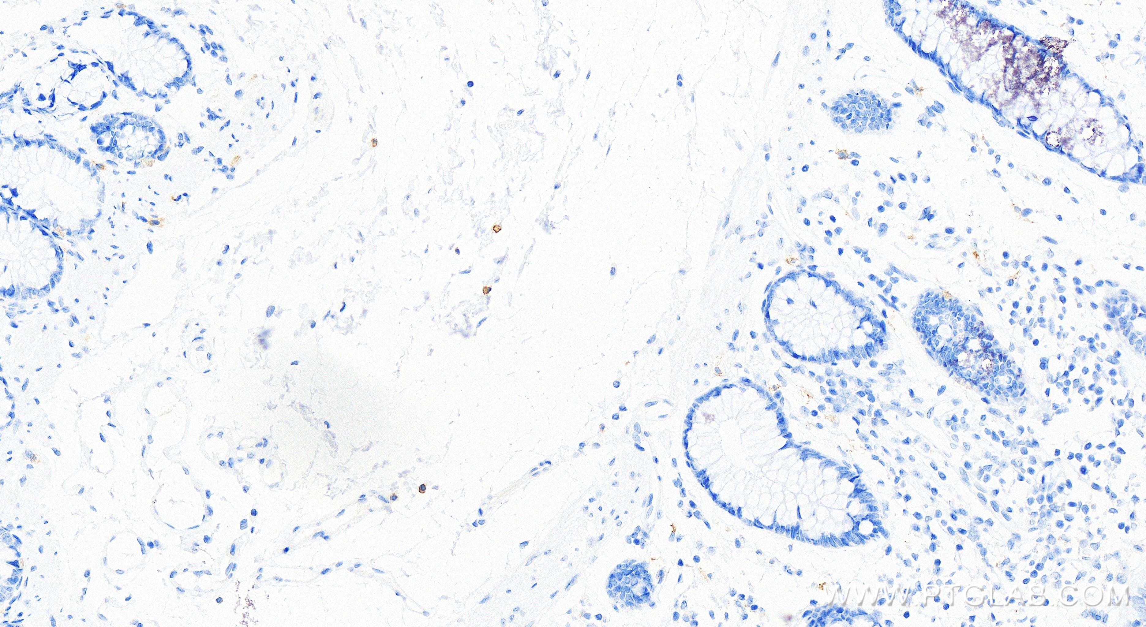 Immunohistochemistry (IHC) staining of human colon tissue using CD117/c-Kit Recombinant antibody (84259-3-RR)