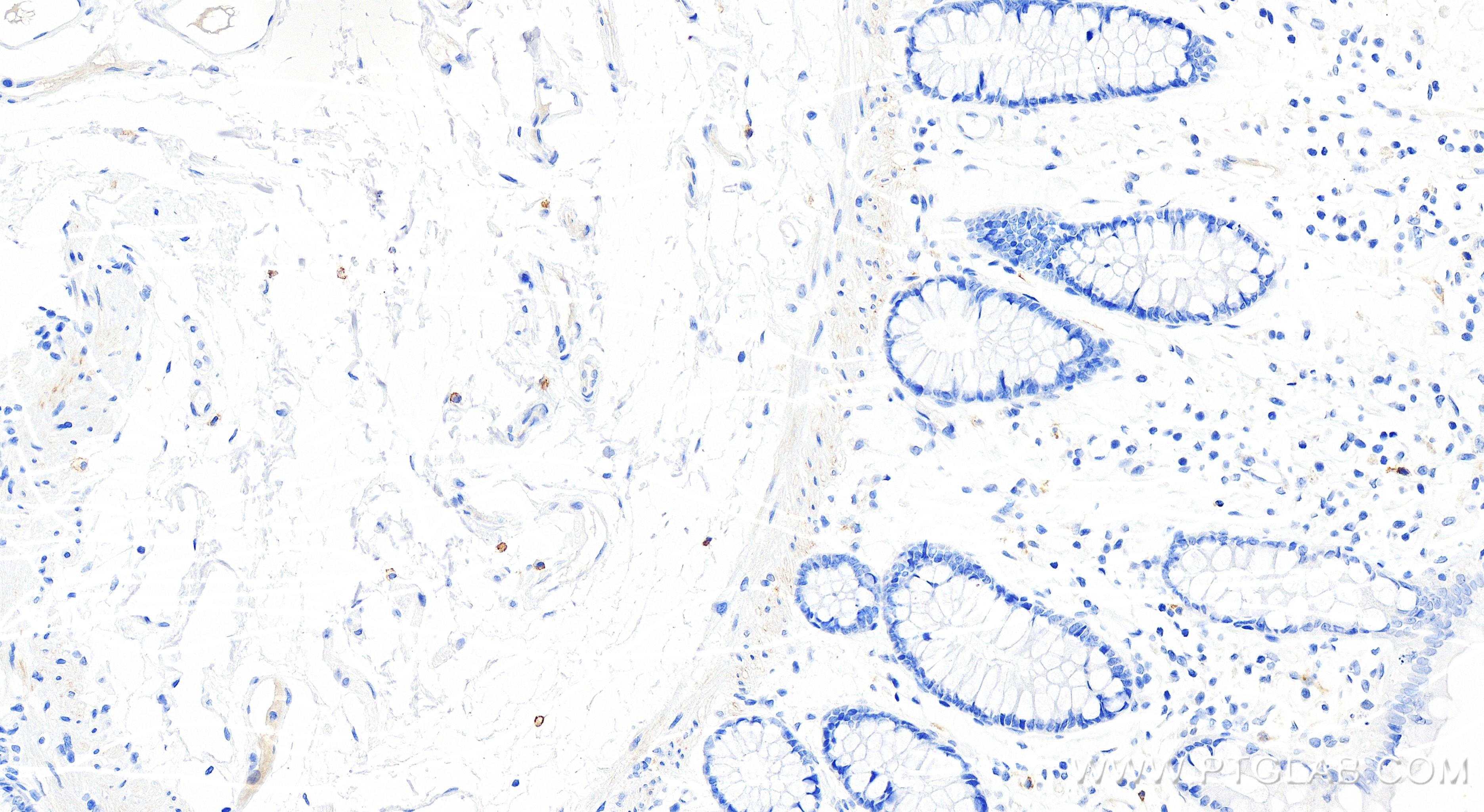 Immunohistochemistry (IHC) staining of human colon tissue using CD117/c-Kit Recombinant antibody (84259-5-RR)