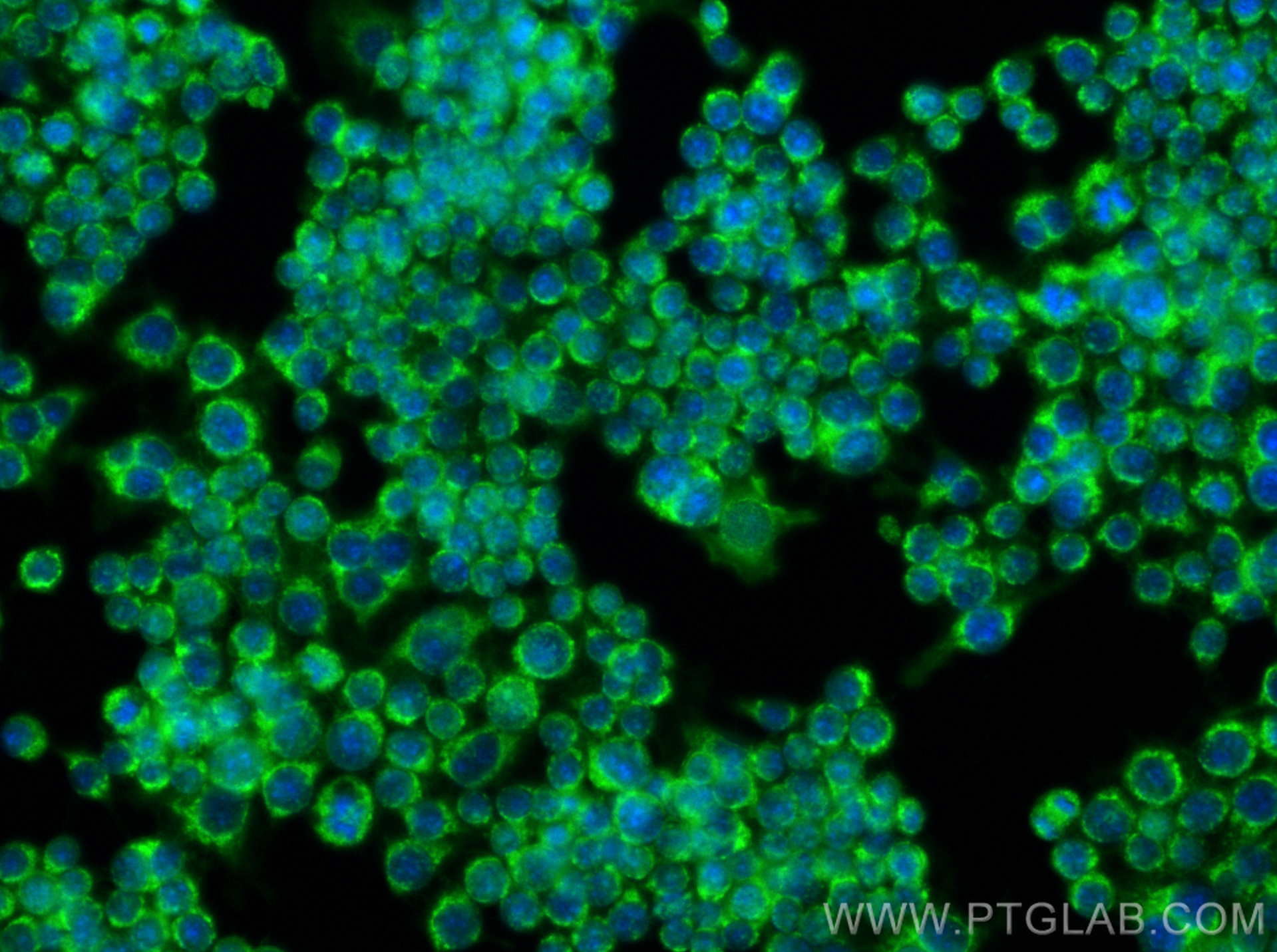 Immunofluorescence (IF) / fluorescent staining of RAW 264.7 cells using CD11b Polyclonal antibody (31745-1-AP)