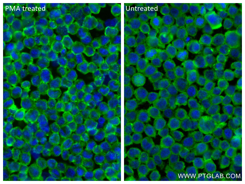 Immunofluorescence (IF) / fluorescent staining of THP-1 cells using CD11c/Integrin alpha X Recombinant antibody (81853-1-RR)