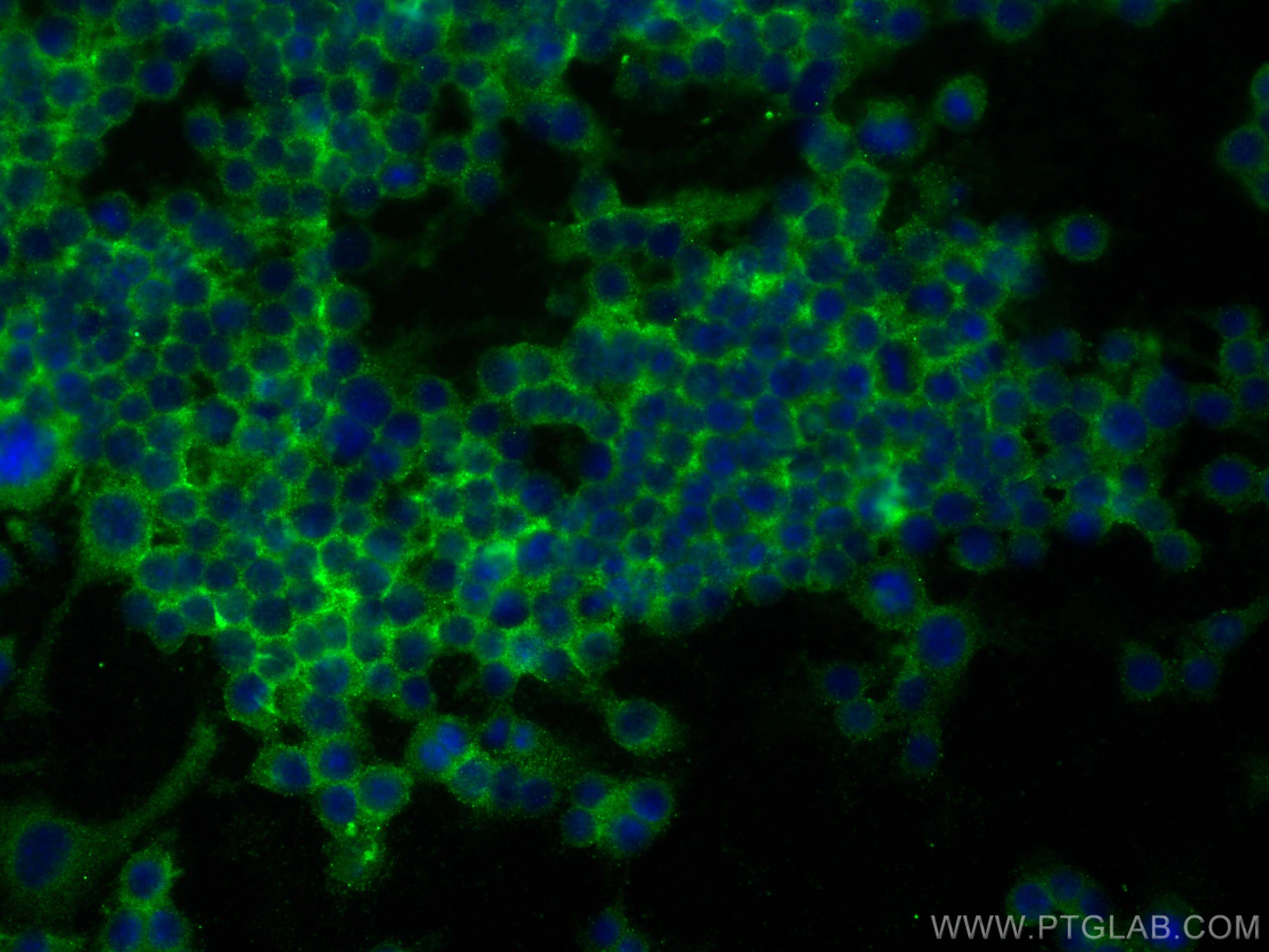 Immunofluorescence (IF) / fluorescent staining of RAW 264.7 cells using CD14 Polyclonal antibody (17000-1-AP)