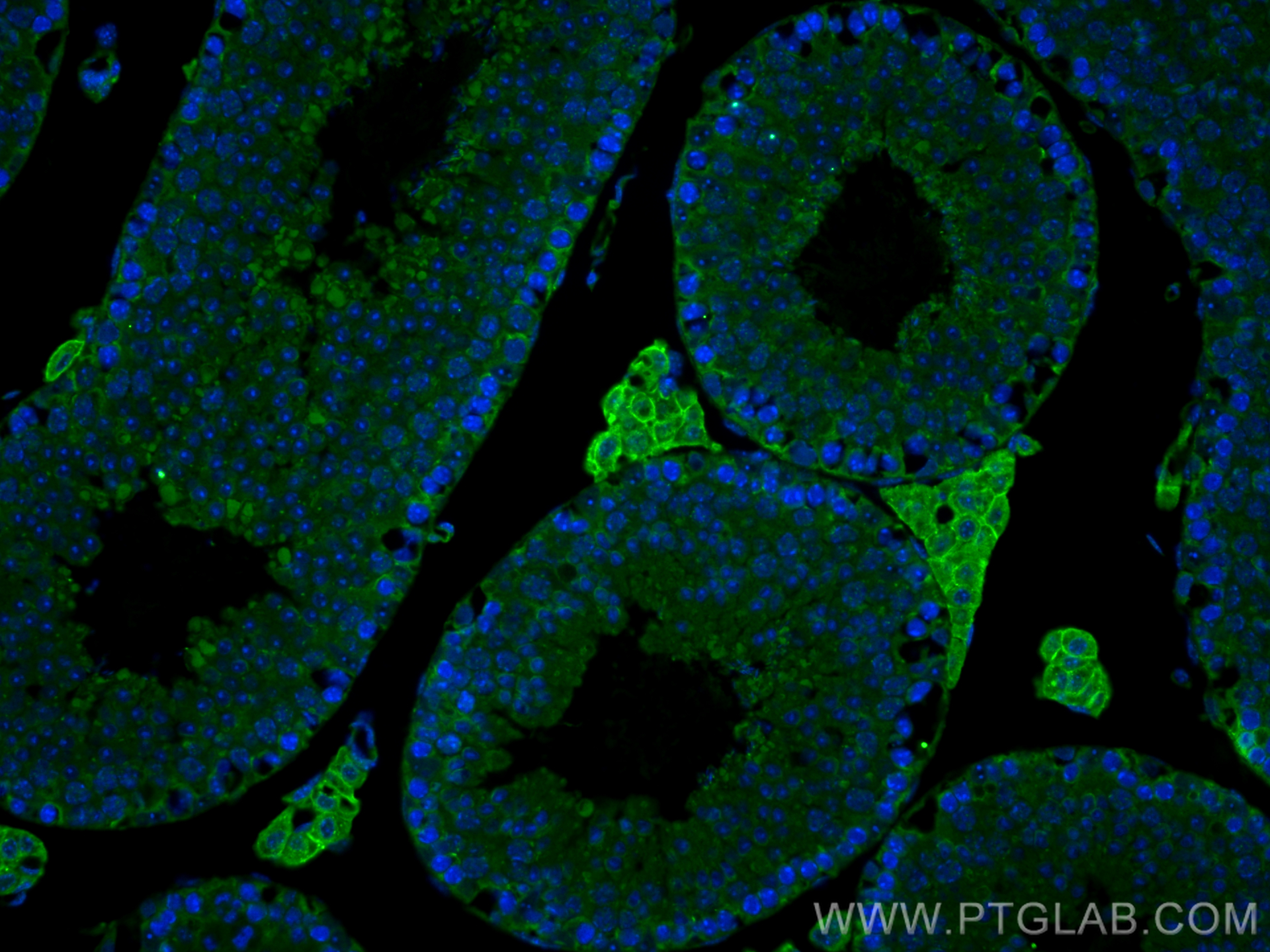 Immunofluorescence (IF) / fluorescent staining of mouse testis tissue using CD14 Polyclonal antibody (17000-1-AP)