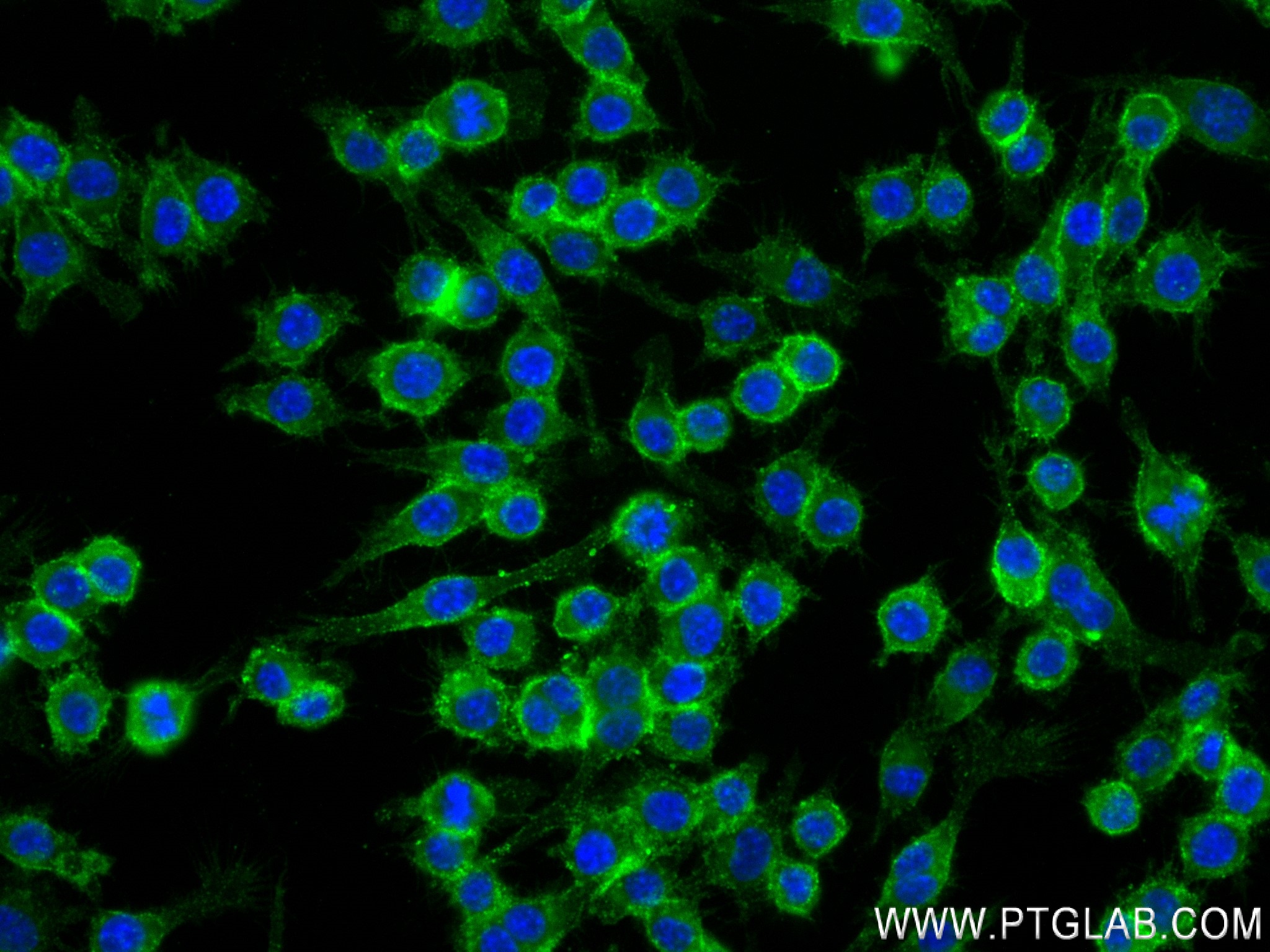 Immunofluorescence (IF) / fluorescent staining of RAW 264.7 cells using CD14 Recombinant antibody (83297-8-RR)