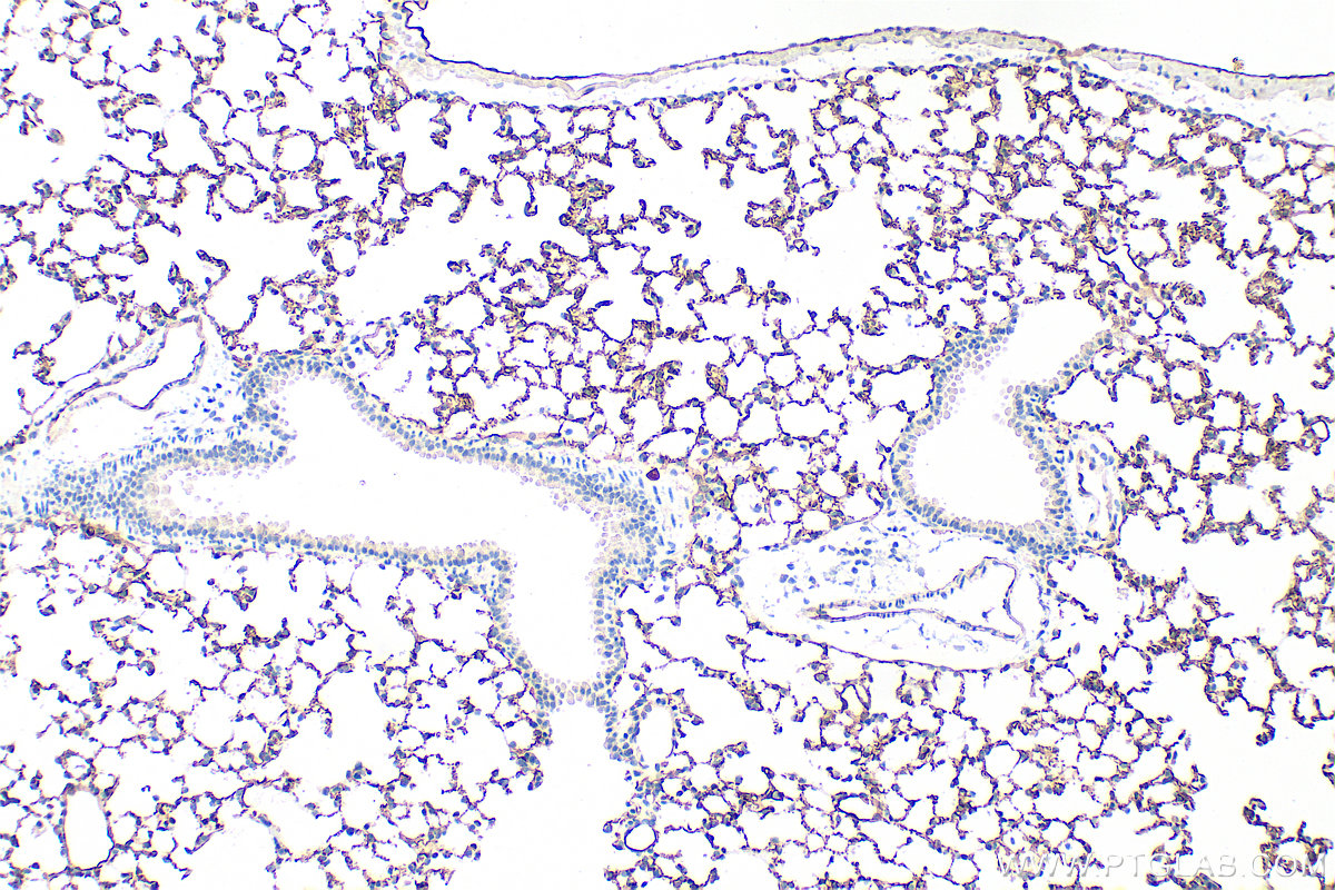 Immunohistochemistry (IHC) staining of mouse lung tissue using CD141/Thrombomodulin Polyclonal antibody (31339-1-AP)