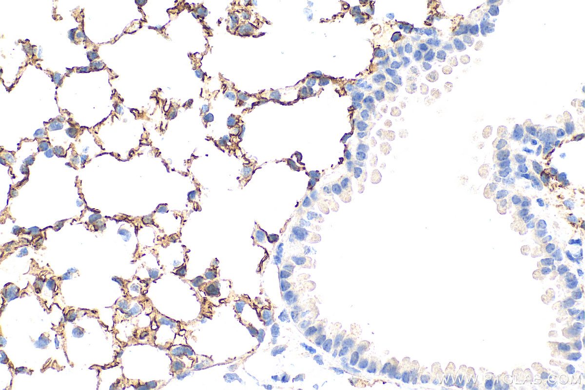 Immunohistochemistry (IHC) staining of mouse lung tissue using CD141/Thrombomodulin Polyclonal antibody (31339-1-AP)