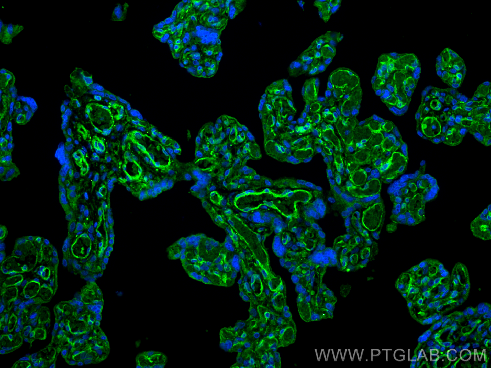 Immunofluorescence (IF) / fluorescent staining of human placenta tissue using CD146/MCAM Monoclonal antibody (66153-1-Ig)