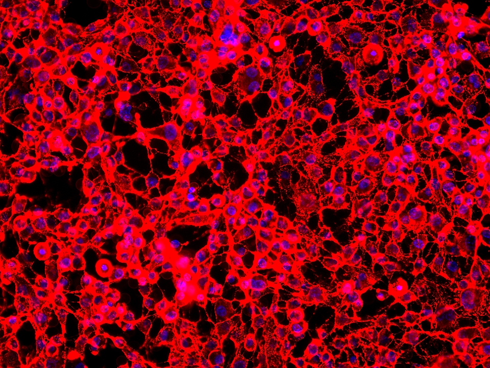 Immunofluorescence (IF) / fluorescent staining of HUVEC cells using Anti-Human CD146 (P1H12) (65181-1-Ig)