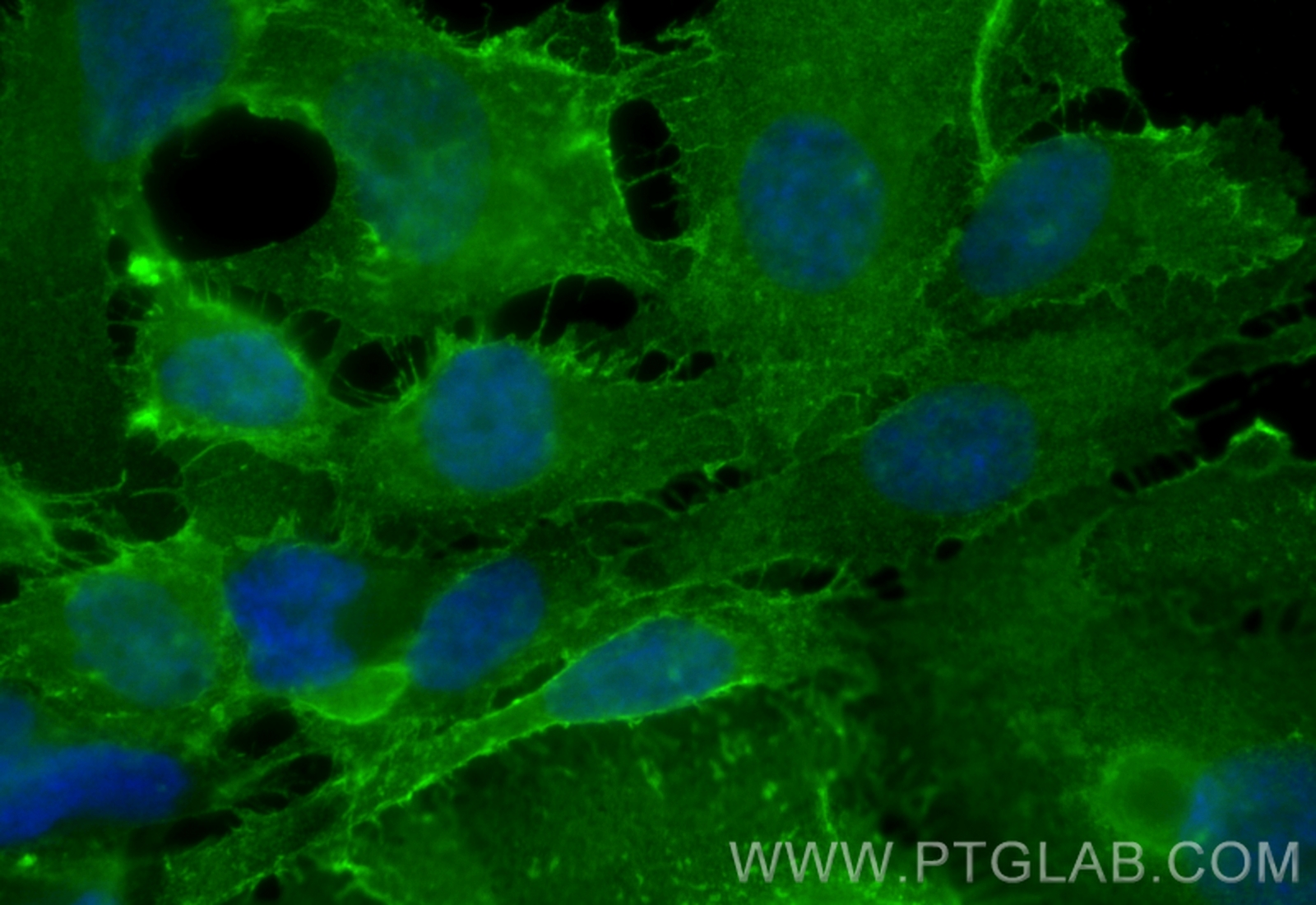 Immunofluorescence (IF) / fluorescent staining of HUVEC cells using CoraLite® Plus 488-conjugated CD146/MCAM Polyclona (CL488-17564)