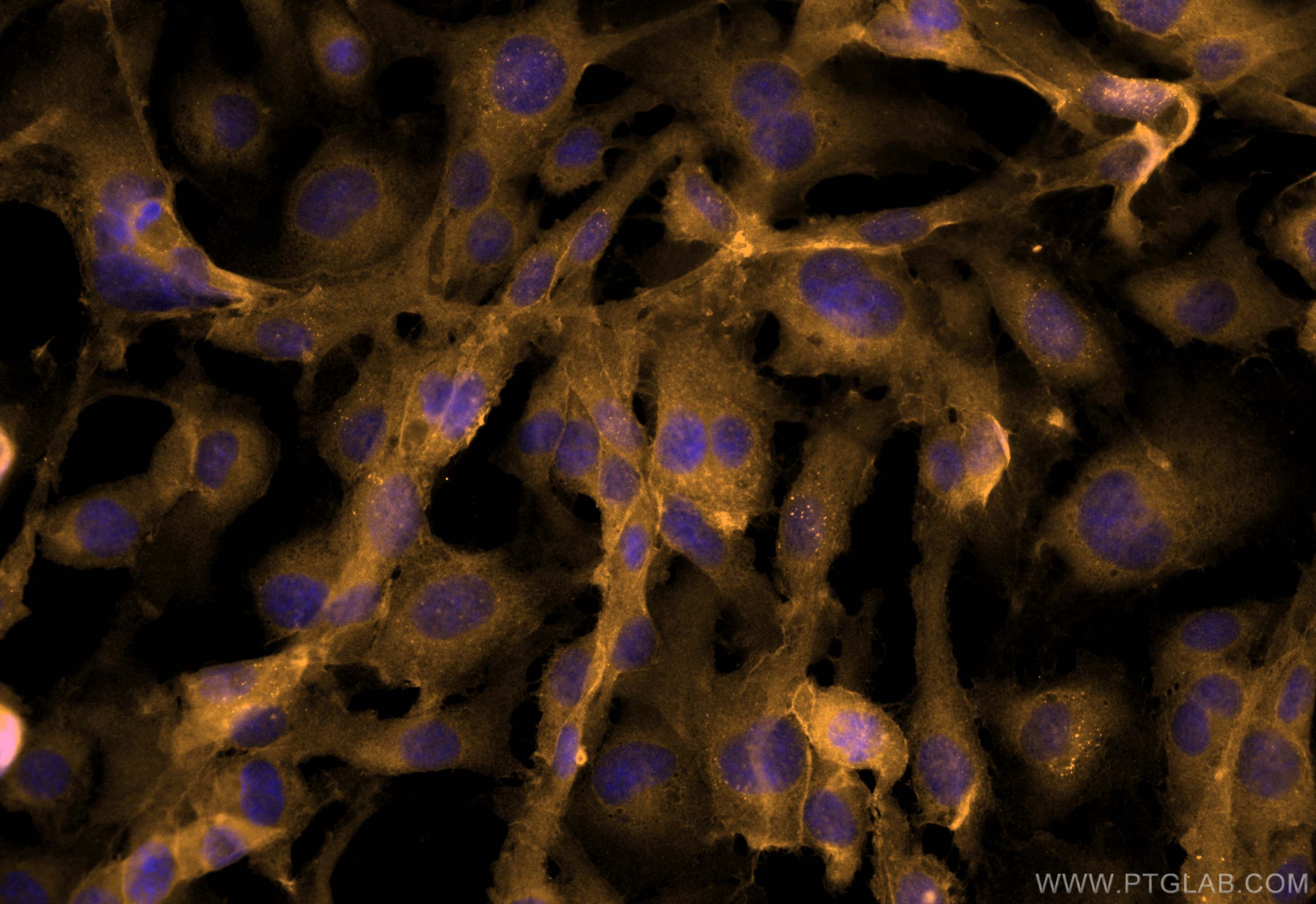 Immunofluorescence (IF) / fluorescent staining of HUVEC cells using CoraLite®555-conjugated CD146/MCAM Monoclonal anti (CL555-66153)