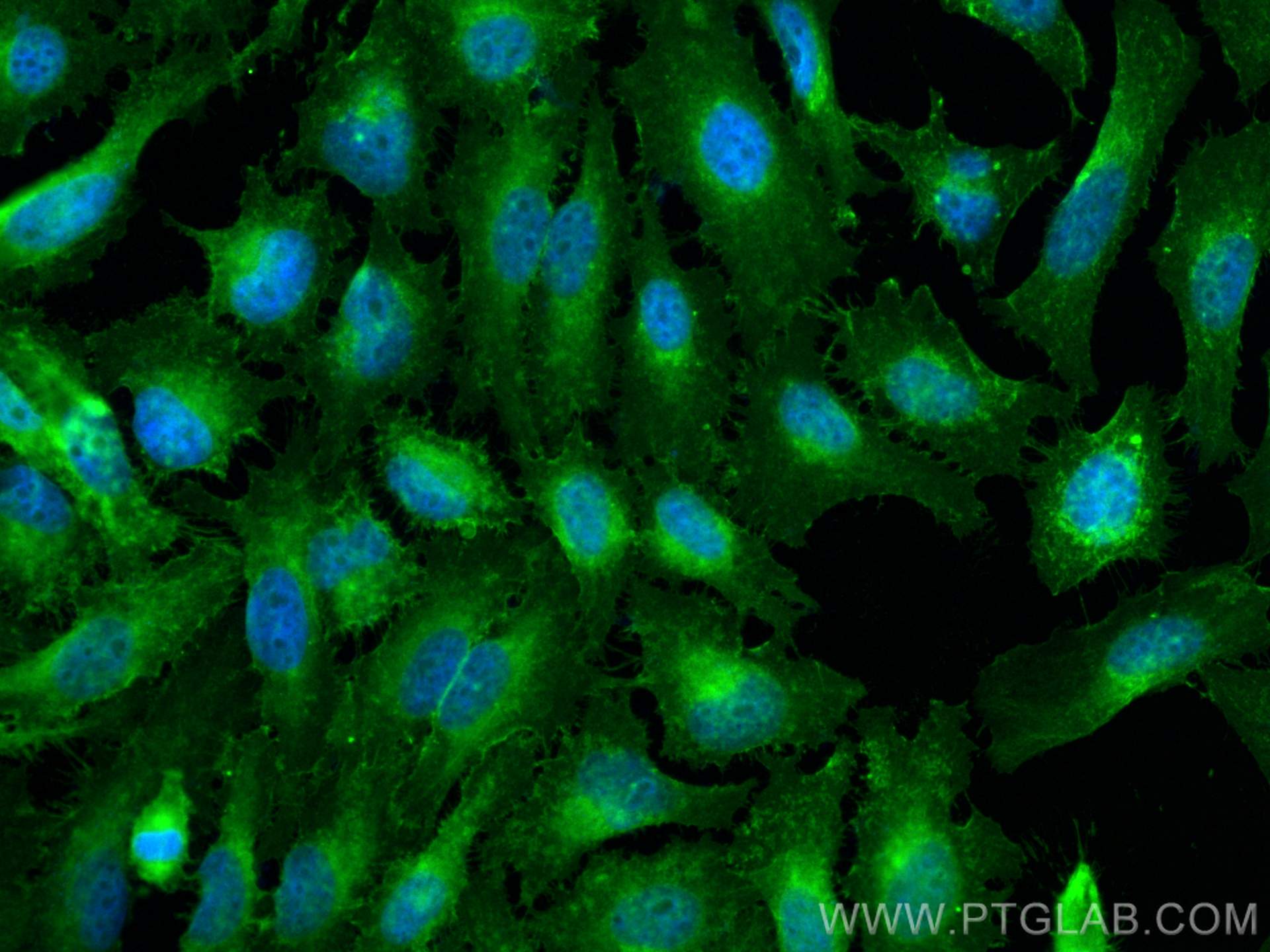 Immunofluorescence (IF) / fluorescent staining of HeLa cells using CD147 Polyclonal antibody (30880-1-AP)