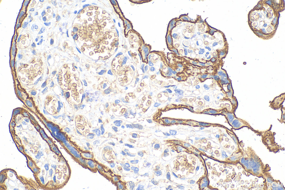 Immunohistochemistry (IHC) staining of human placenta tissue using CD147 Polyclonal antibody (30880-1-AP)