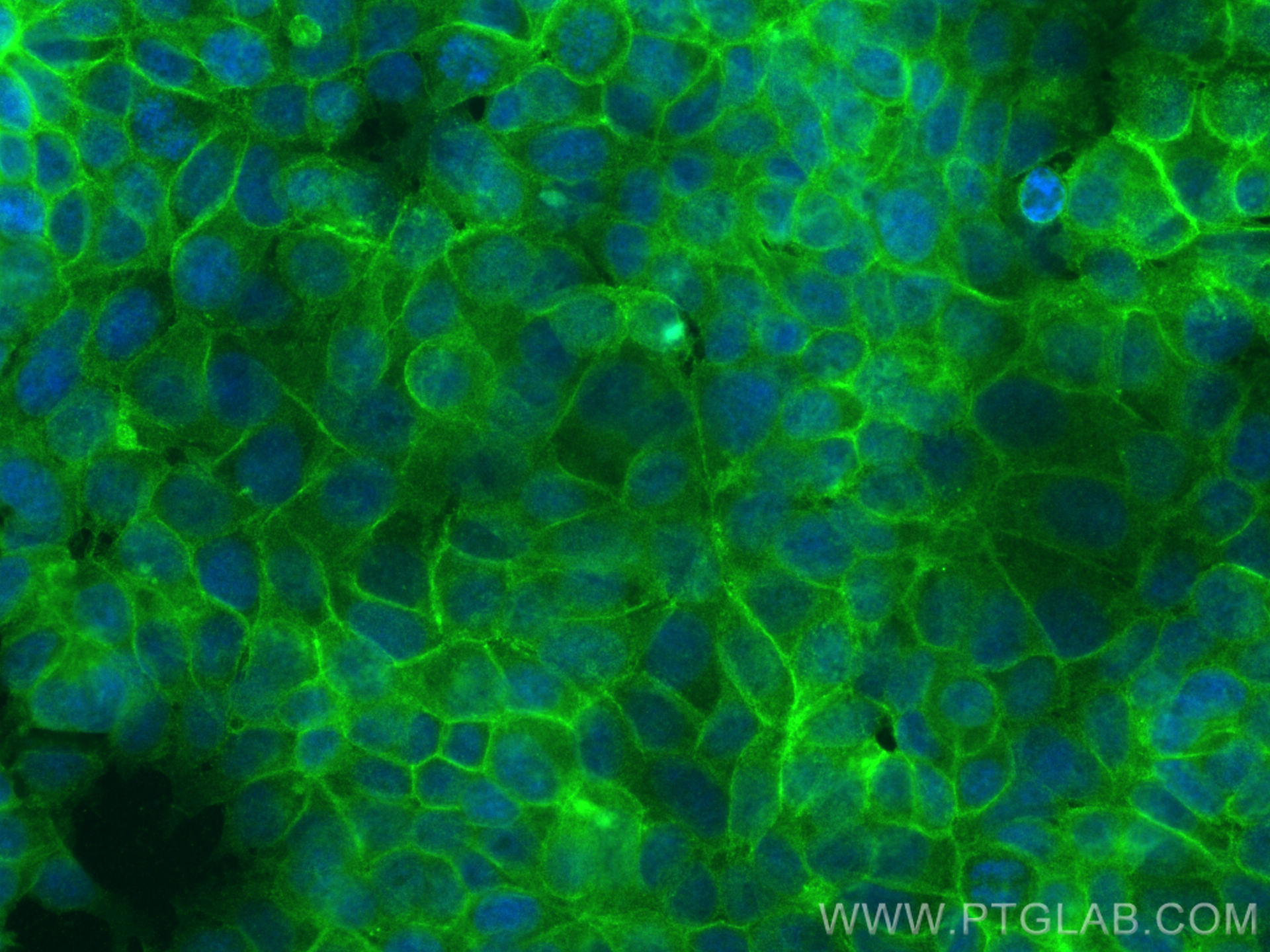 Immunofluorescence (IF) / fluorescent staining of MCF-7 cells using CD147 Recombinant antibody (82909-1-RR)