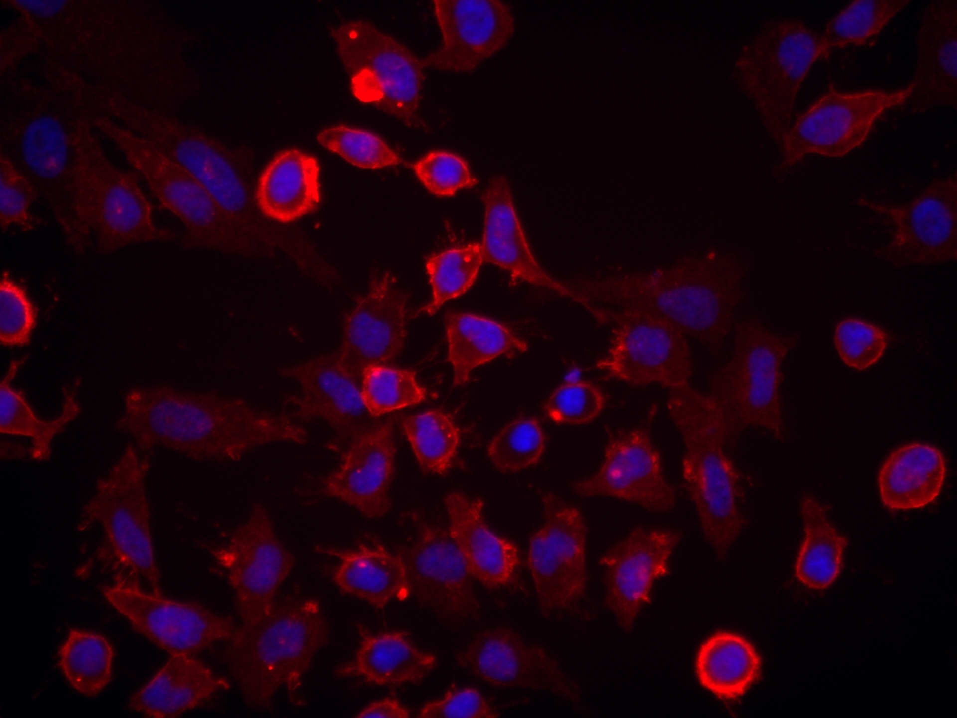Immunofluorescence (IF) / fluorescent staining of HeLa cells using CD147 Recombinant antibody (82909-7-RR)