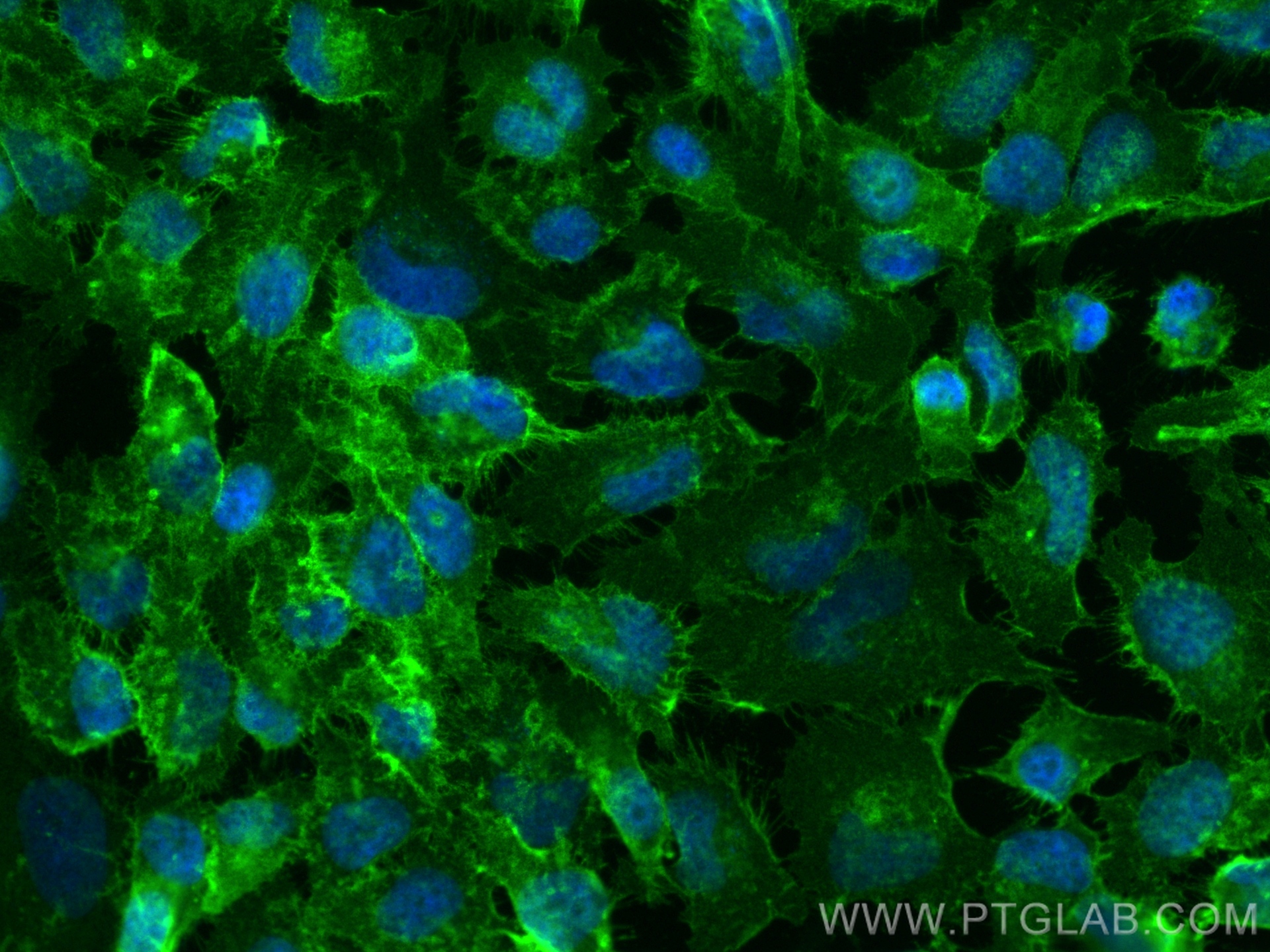 Immunofluorescence (IF) / fluorescent staining of HeLa cells using CD147 Recombinant antibody (82909-7-RR)