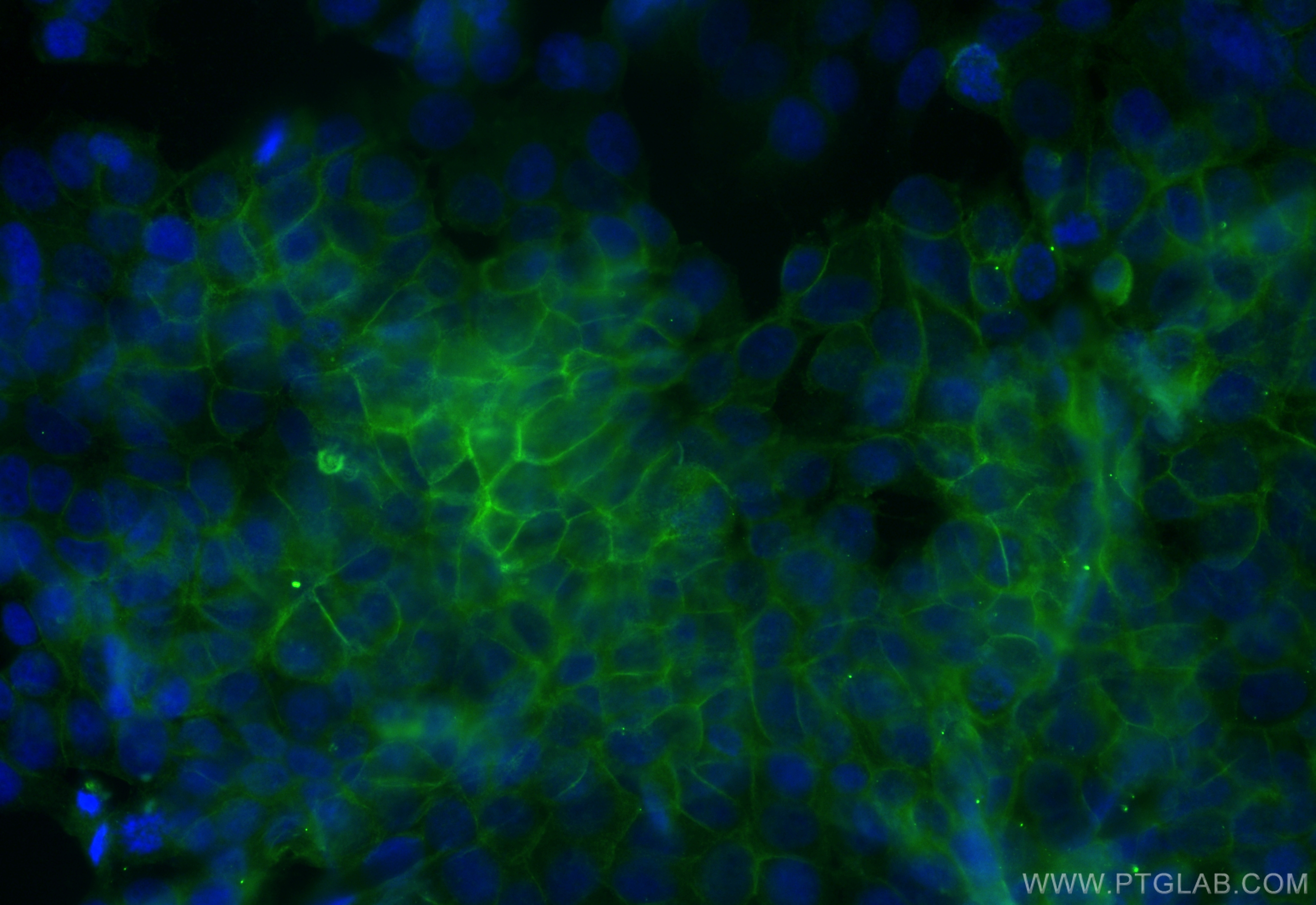 Immunofluorescence (IF) / fluorescent staining of MCF-7 cells using CoraLite® Plus 488-conjugated CD147 Recombinant an (CL488-82909)