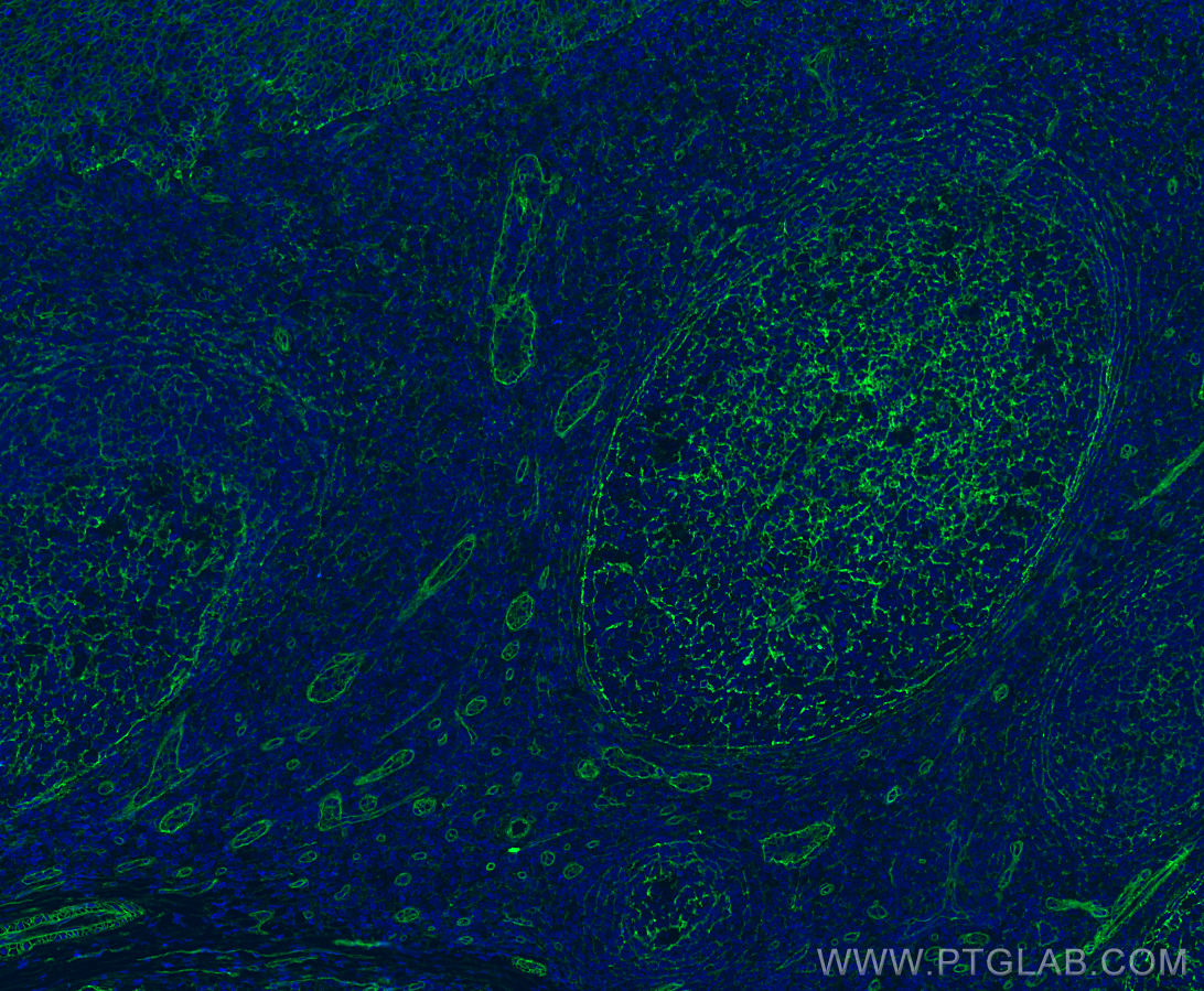 Immunofluorescence (IF) / fluorescent staining of human tonsillitis tissue using CD151 Monoclonal antibody (66567-1-Ig)