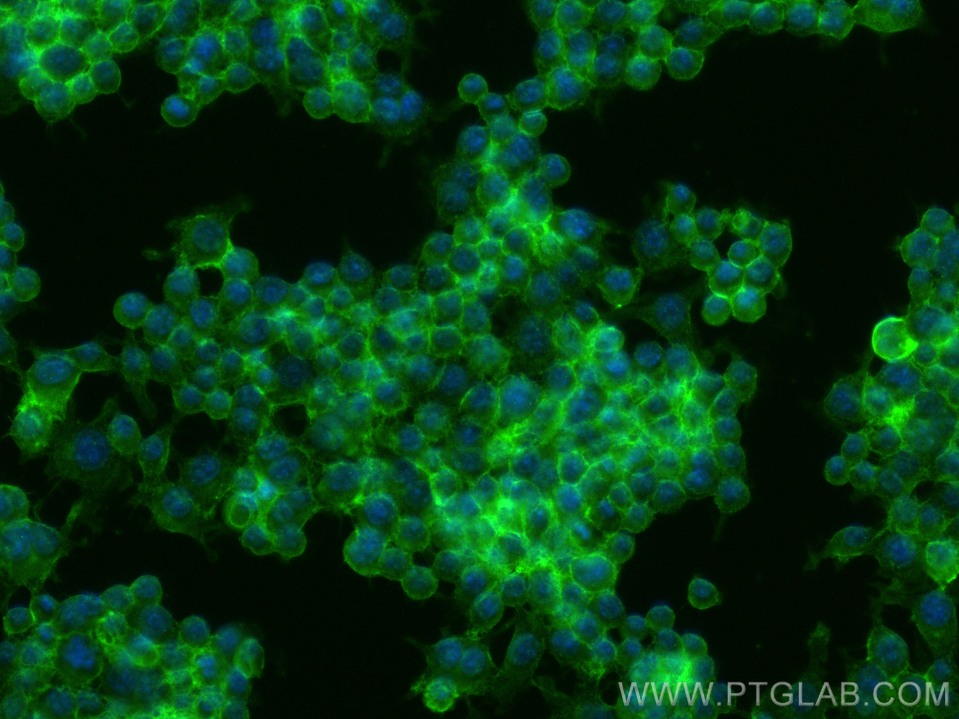 Immunofluorescence (IF) / fluorescent staining of RAW 264.7 cells using CD155/PVR Polyclonal antibody (31447-1-AP)