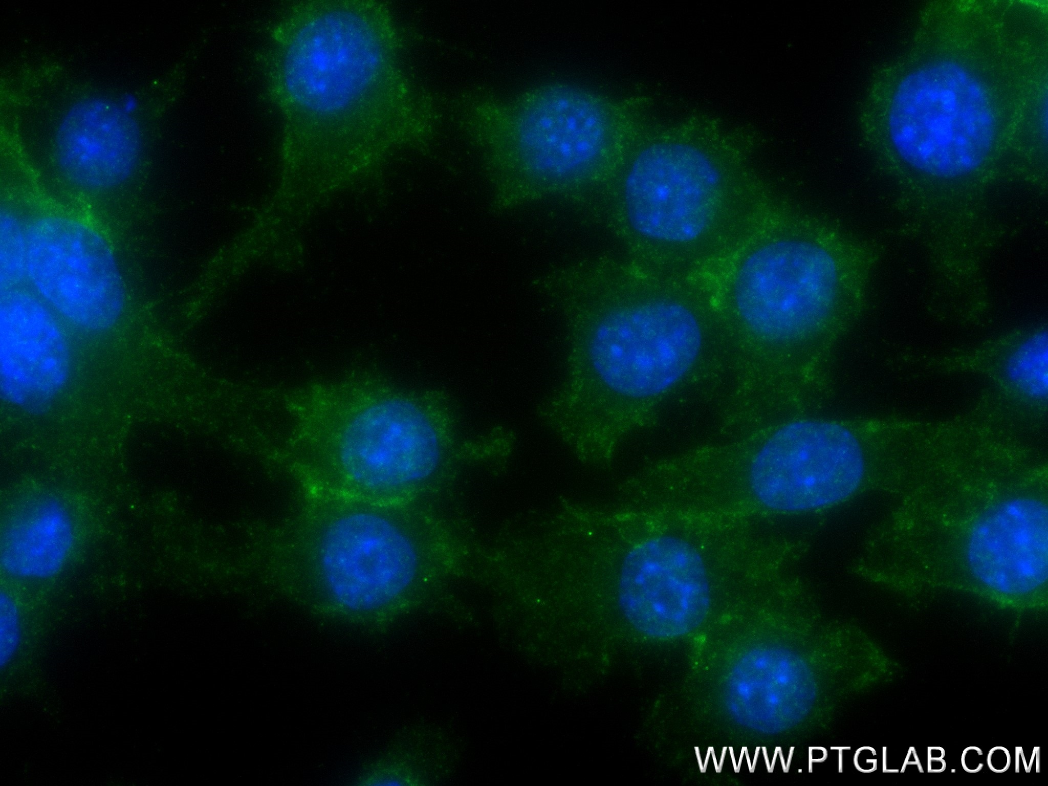Immunofluorescence (IF) / fluorescent staining of RAW 264.7 cells using CD155/PVR Recombinant antibody (83724-6-RR)