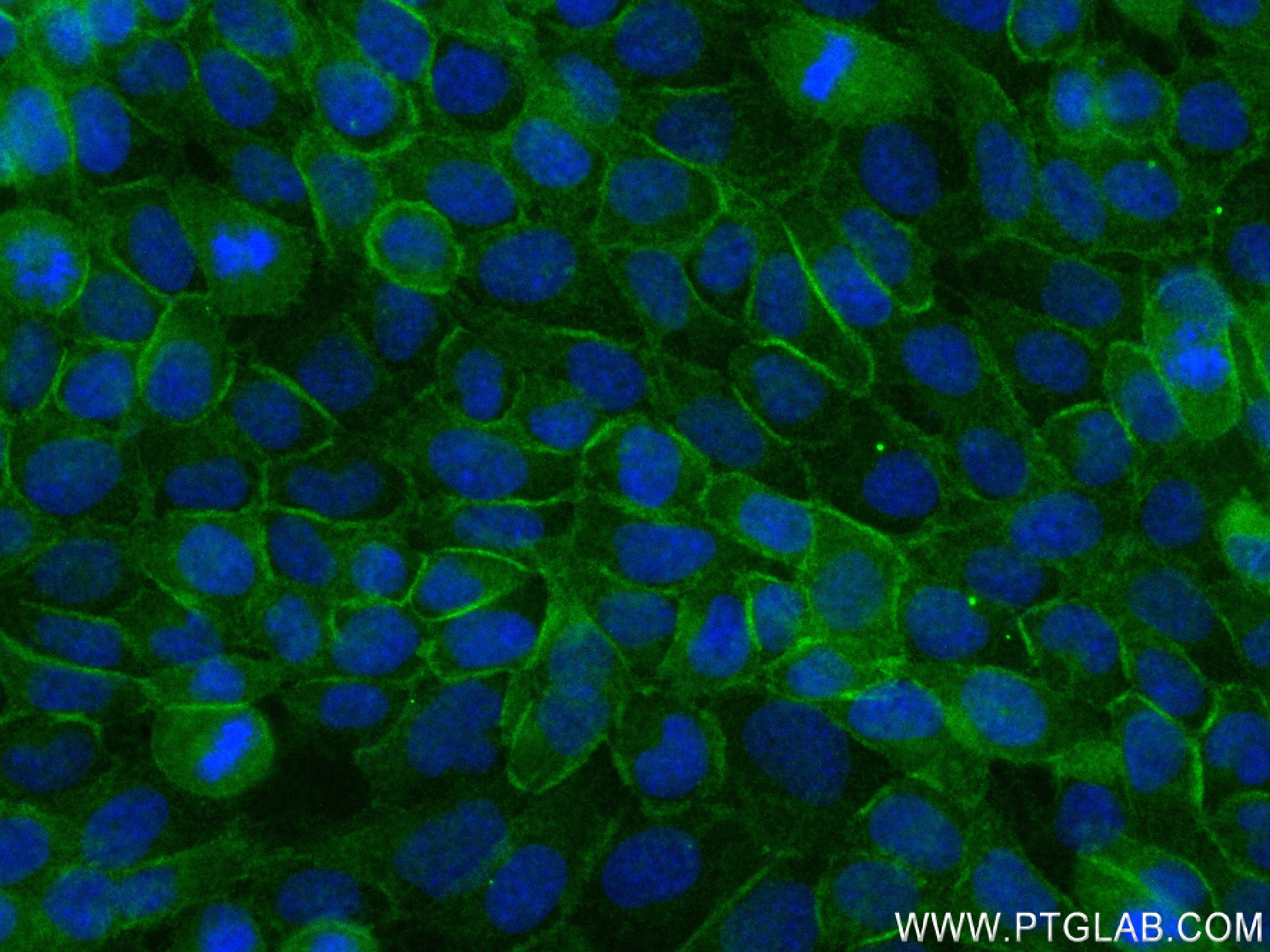 Immunofluorescence (IF) / fluorescent staining of A431 cells using CD155/PVR Recombinant antibody (84138-1-RR)