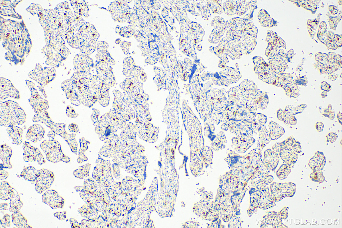 Immunohistochemistry (IHC) staining of human placenta tissue using CD16 Polyclonal antibody (16559-1-AP)