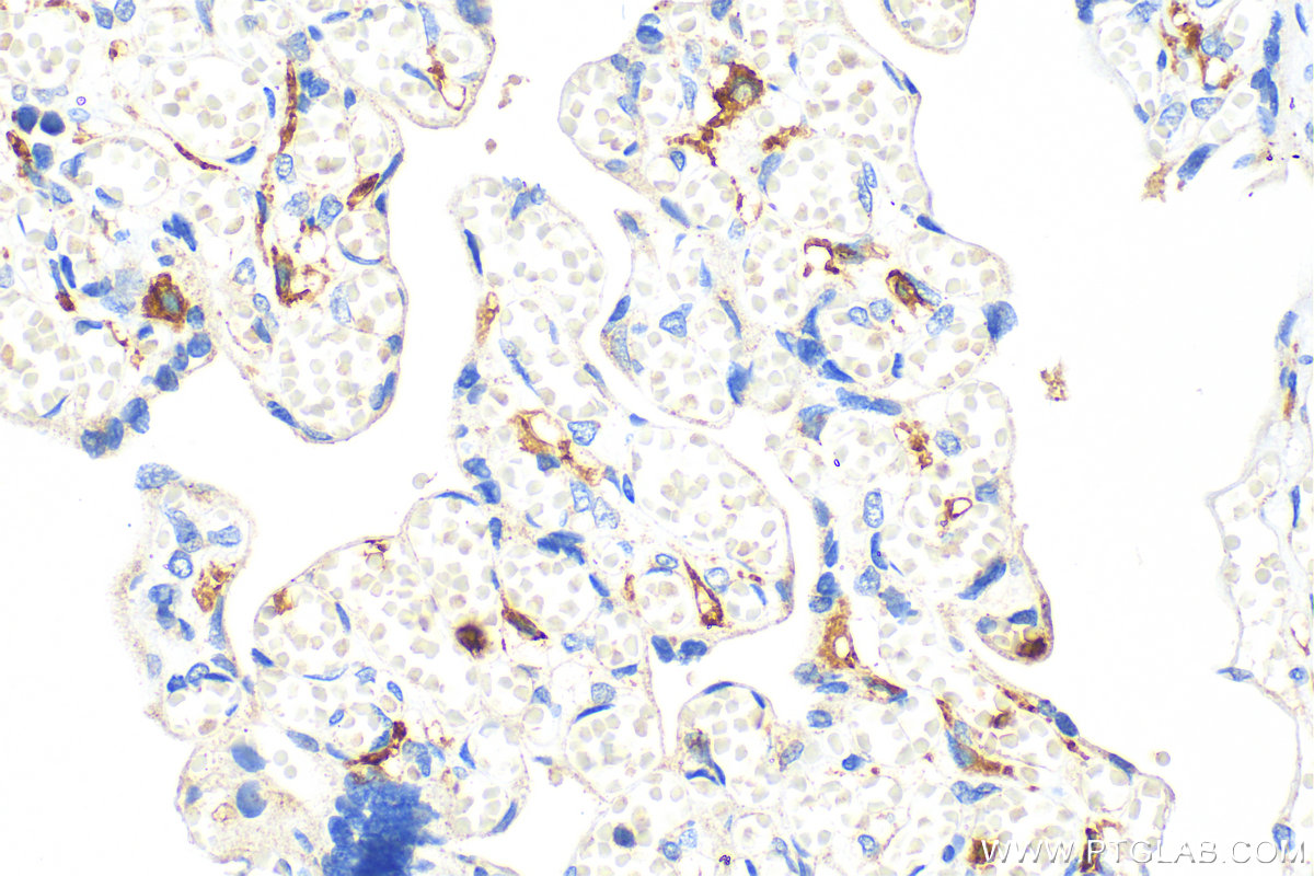 Immunohistochemistry (IHC) staining of human placenta tissue using CD16 Polyclonal antibody (16559-1-AP)