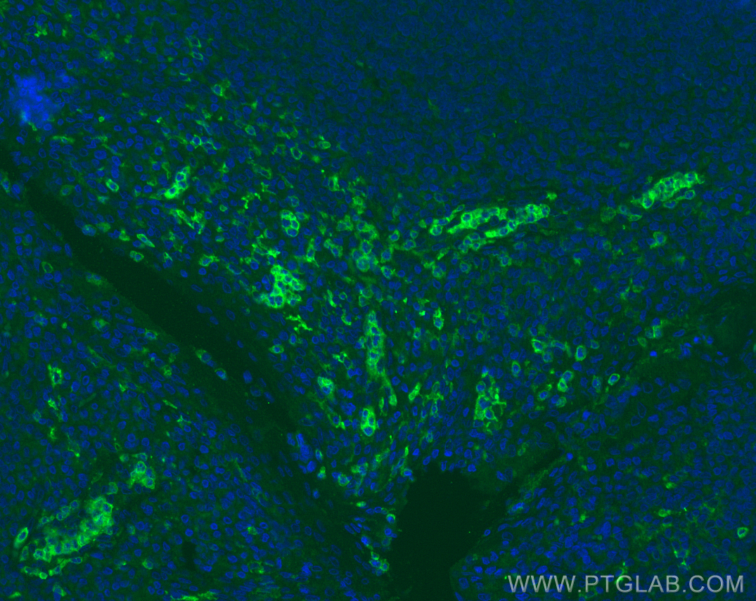 Immunofluorescence (IF) / fluorescent staining of human tonsillitis tissue using CD16 Monoclonal antibody (66779-1-Ig)