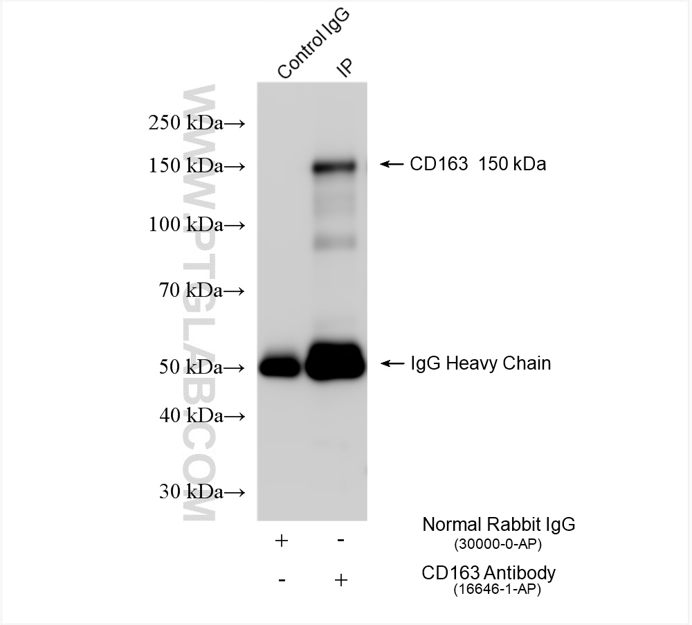 Immunoprecipitation (IP) experiment of human placenta tissue using CD163 Polyclonal antibody (16646-1-AP)