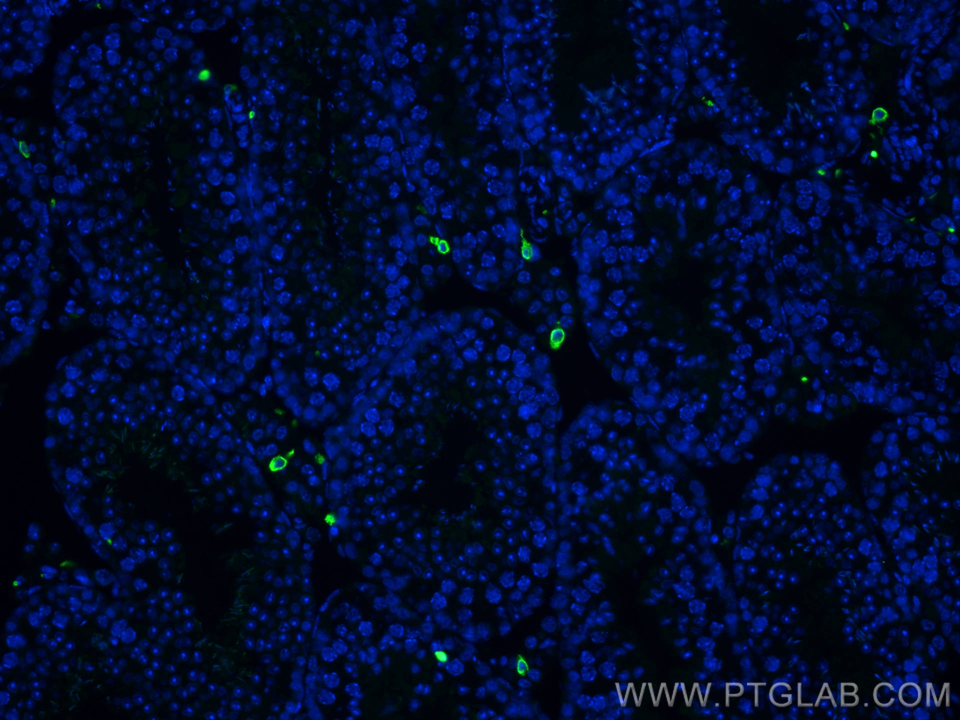 Immunofluorescence (IF) / fluorescent staining of mouse testis tissue using CD163 Polyclonal antibody (31024-1-AP)