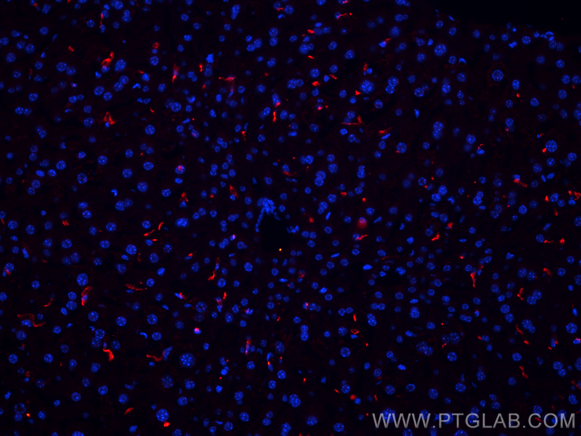 Immunofluorescence (IF) / fluorescent staining of mouse liver tissue using CD163 Polyclonal antibody (31024-1-AP)