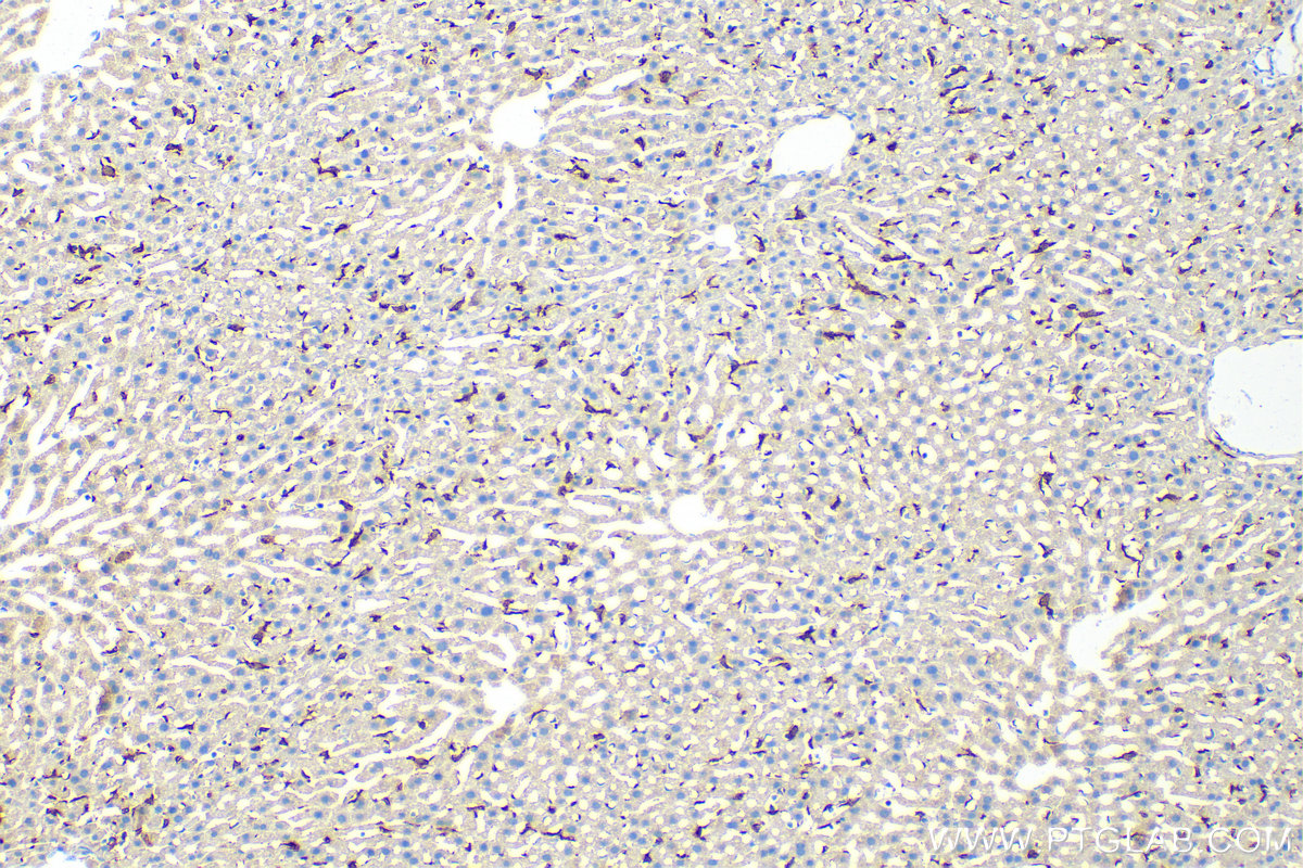 Immunohistochemistry (IHC) staining of mouse liver tissue using CD163 Polyclonal antibody (31024-1-AP)