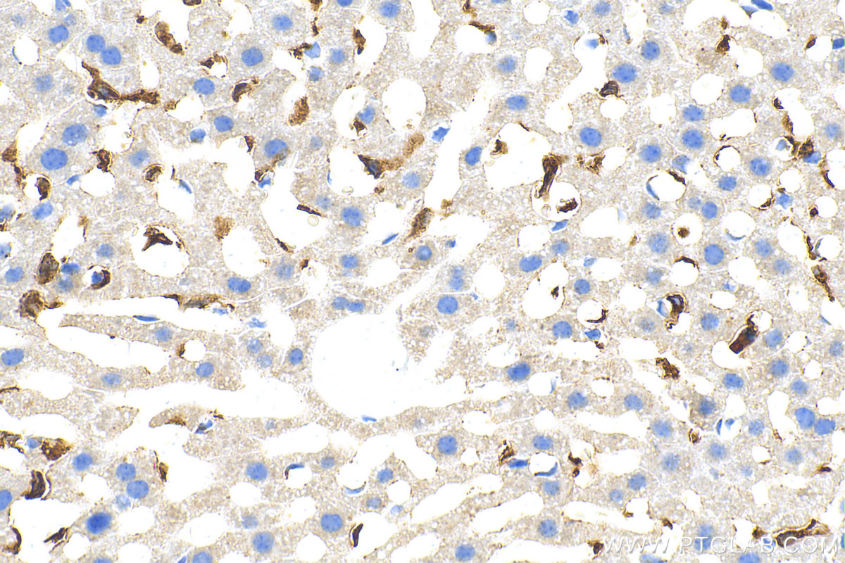 Immunohistochemistry (IHC) staining of mouse liver tissue using CD163 Polyclonal antibody (31024-1-AP)