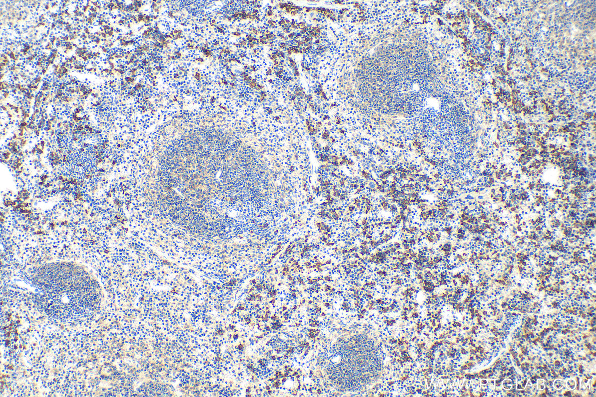 Immunohistochemistry (IHC) staining of mouse spleen tissue using CD163 Polyclonal antibody (31024-1-AP)