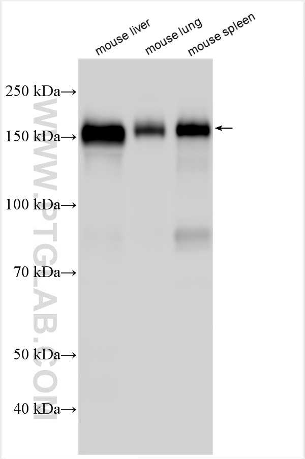 Western Blot (WB) analysis of various lysates using CD163 Polyclonal antibody (31024-1-AP)